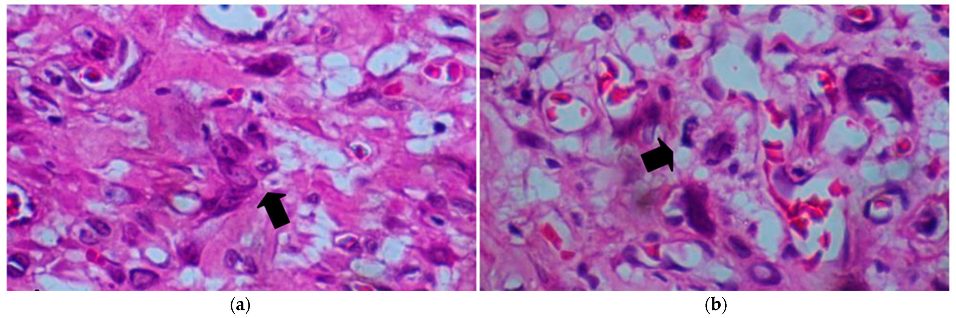 Dermatopathology 11 00030 g004