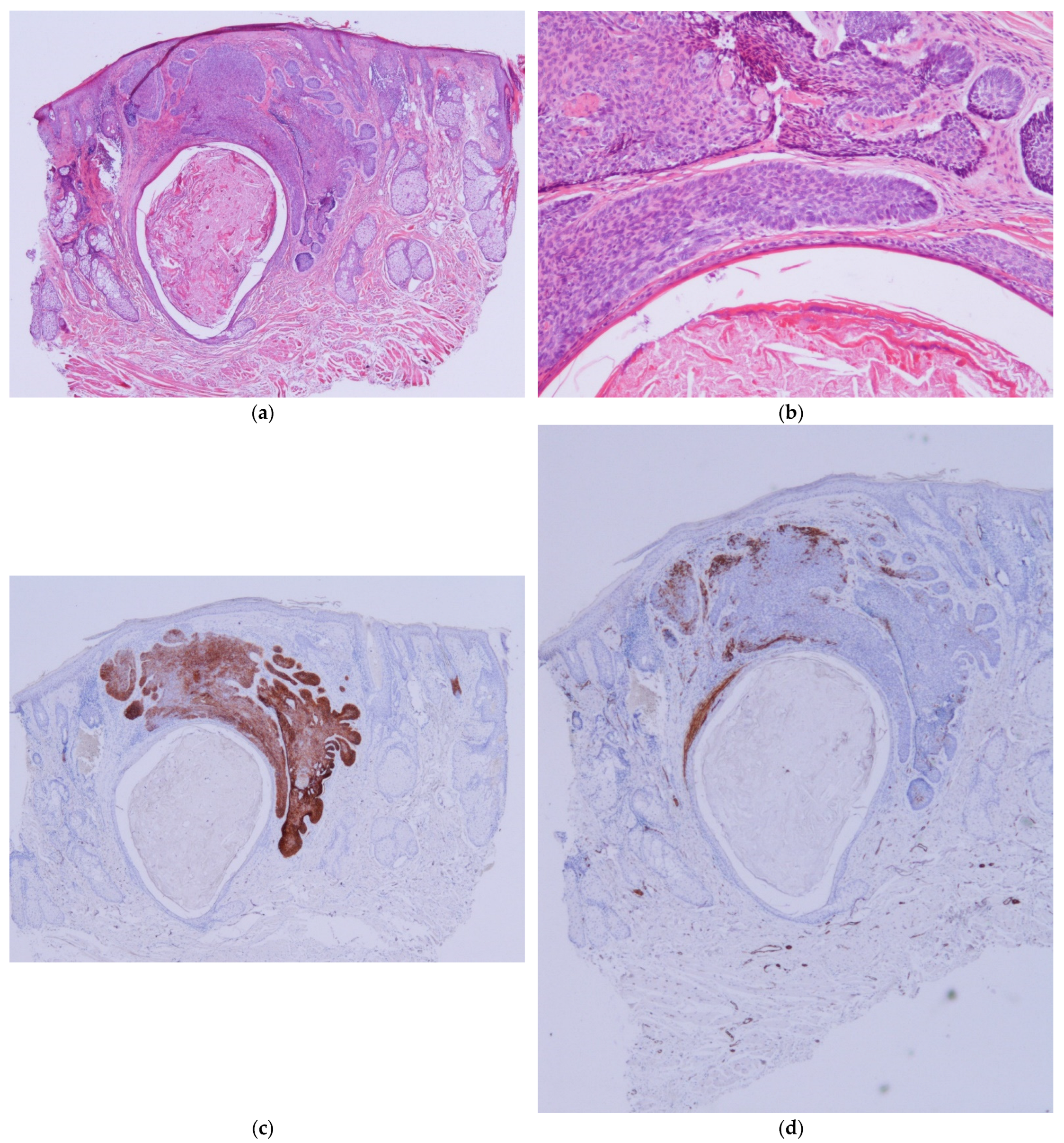 Dermatopathology 11 00032 g003