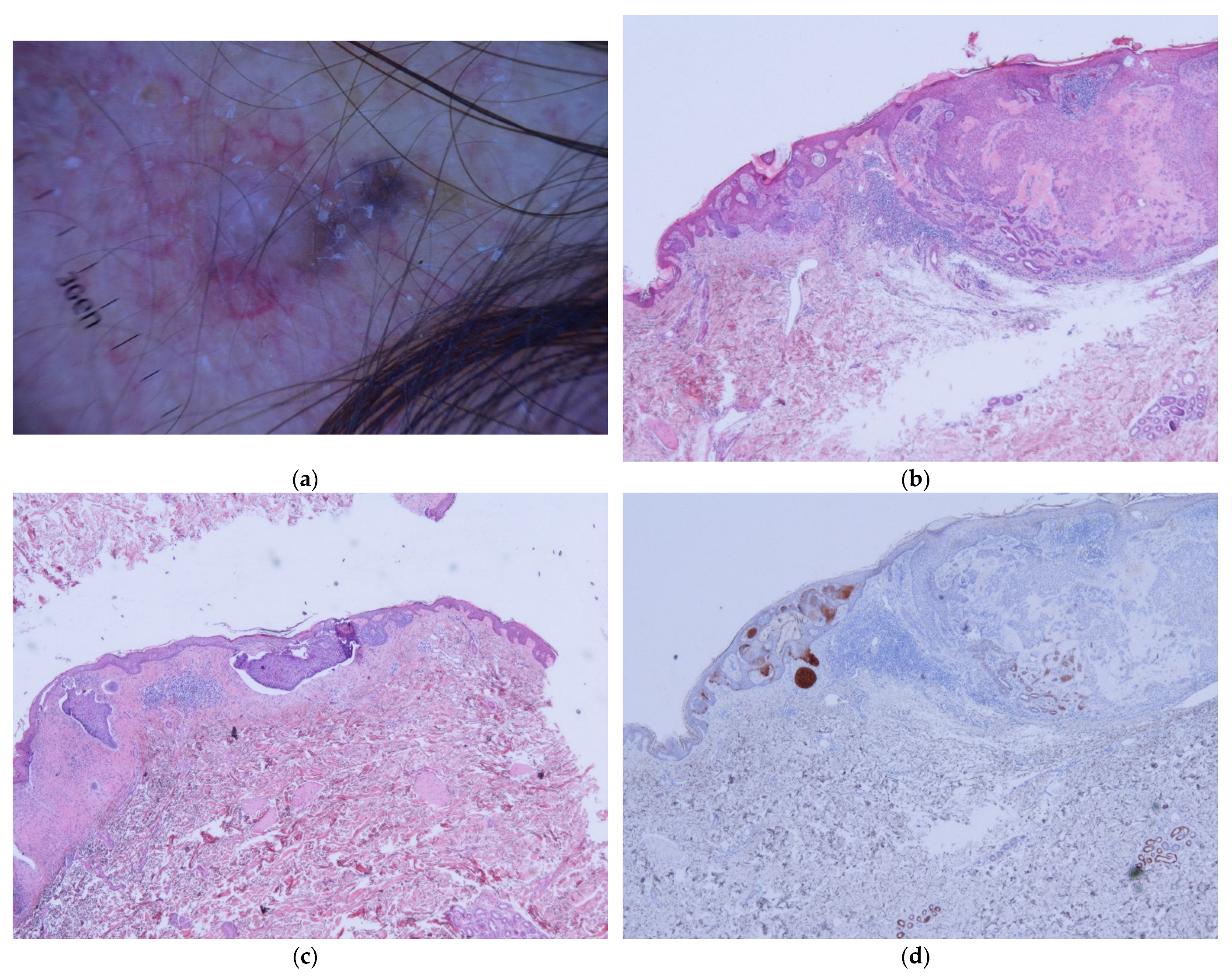 Dermatopathology 11 00032 g004