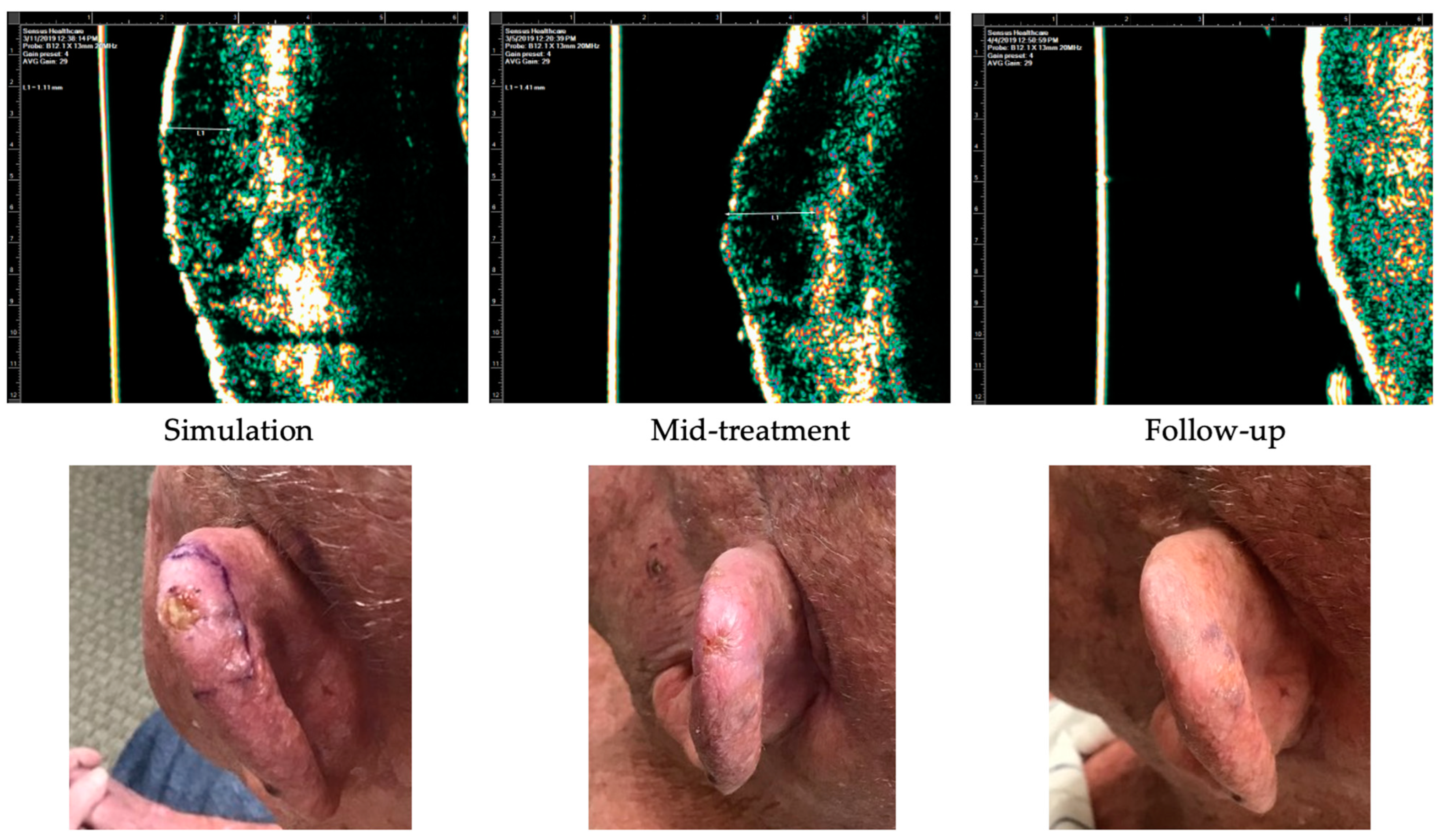 Dermatopathology 11 00033 g008