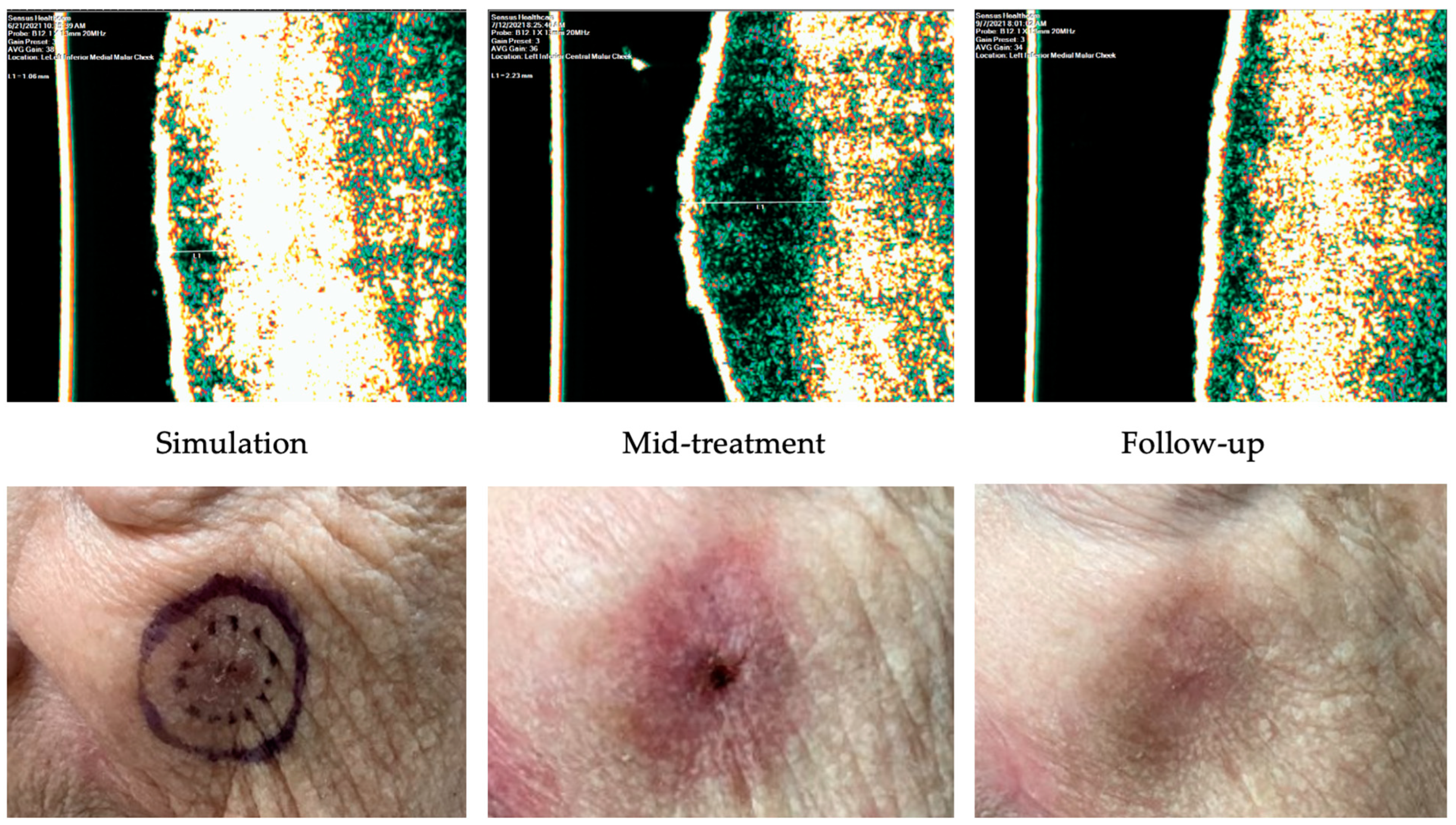Dermatopathology 11 00033 g010