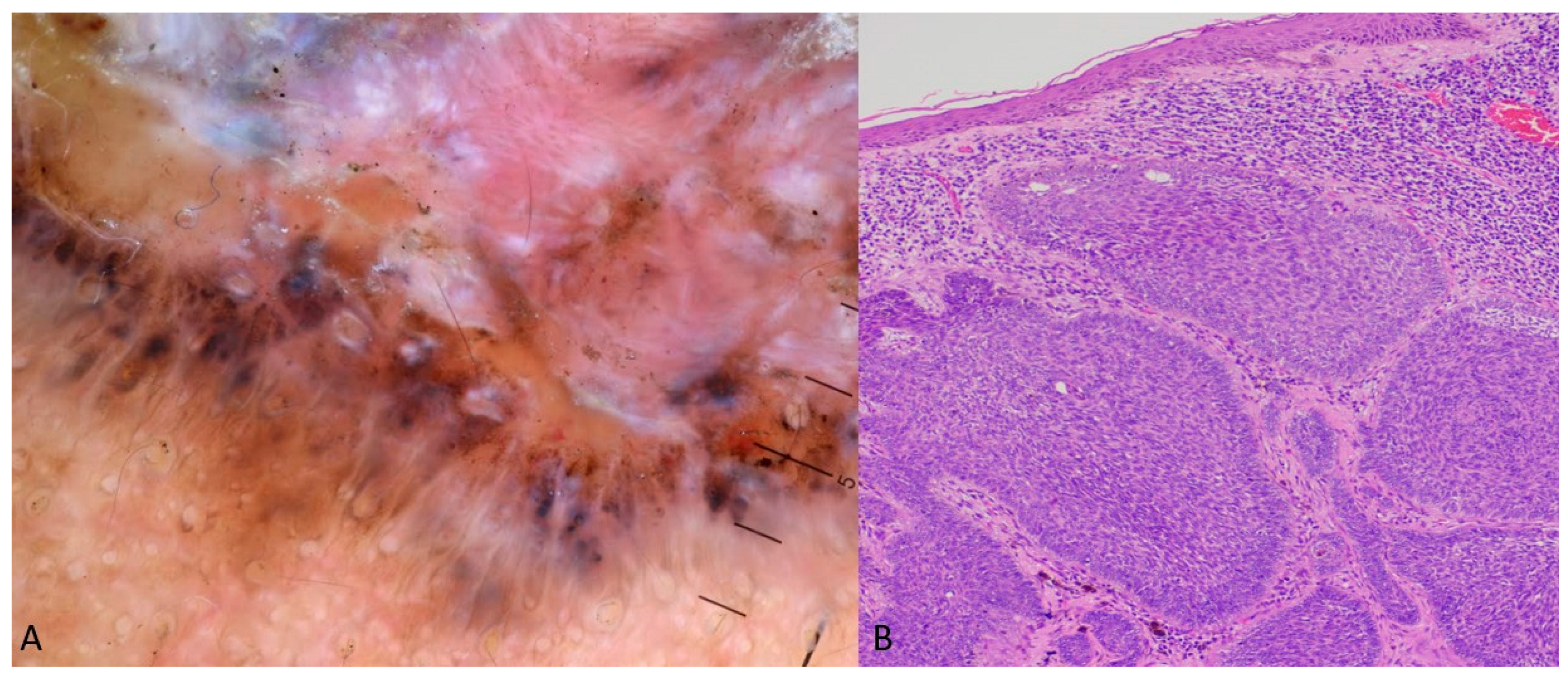 Dermatopathology 11 00035 g001