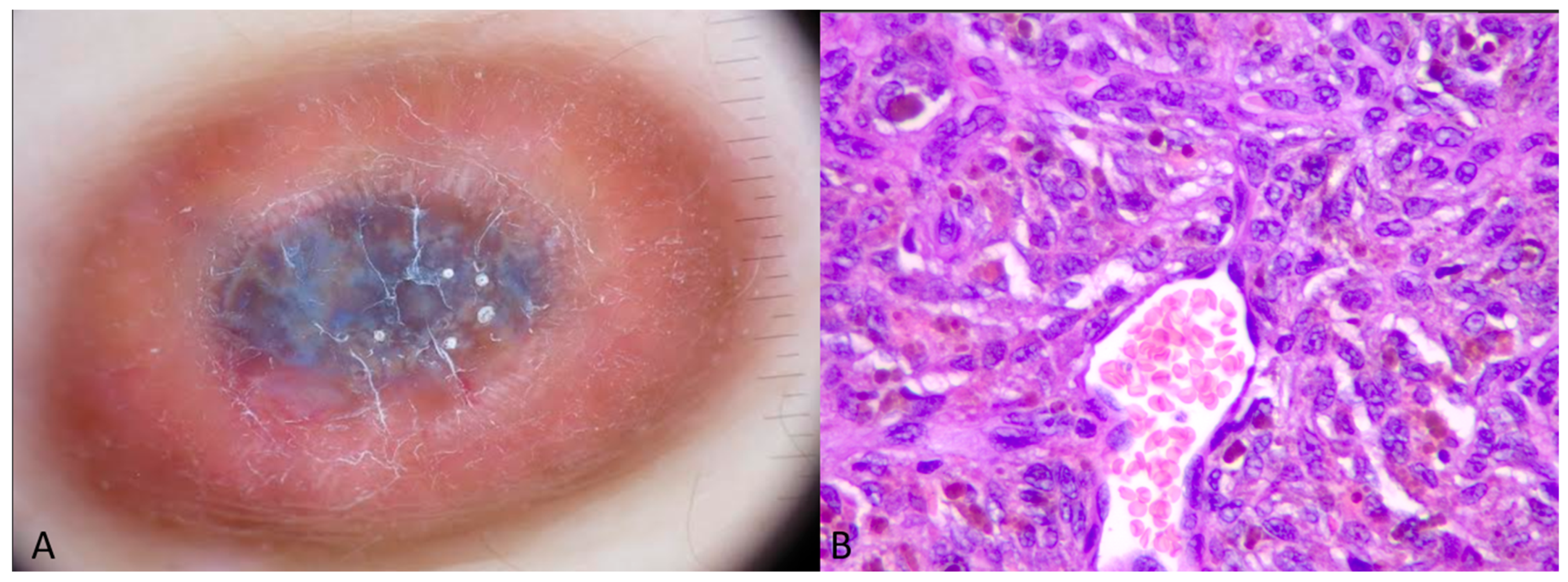 Dermatopathology 11 00035 g002
