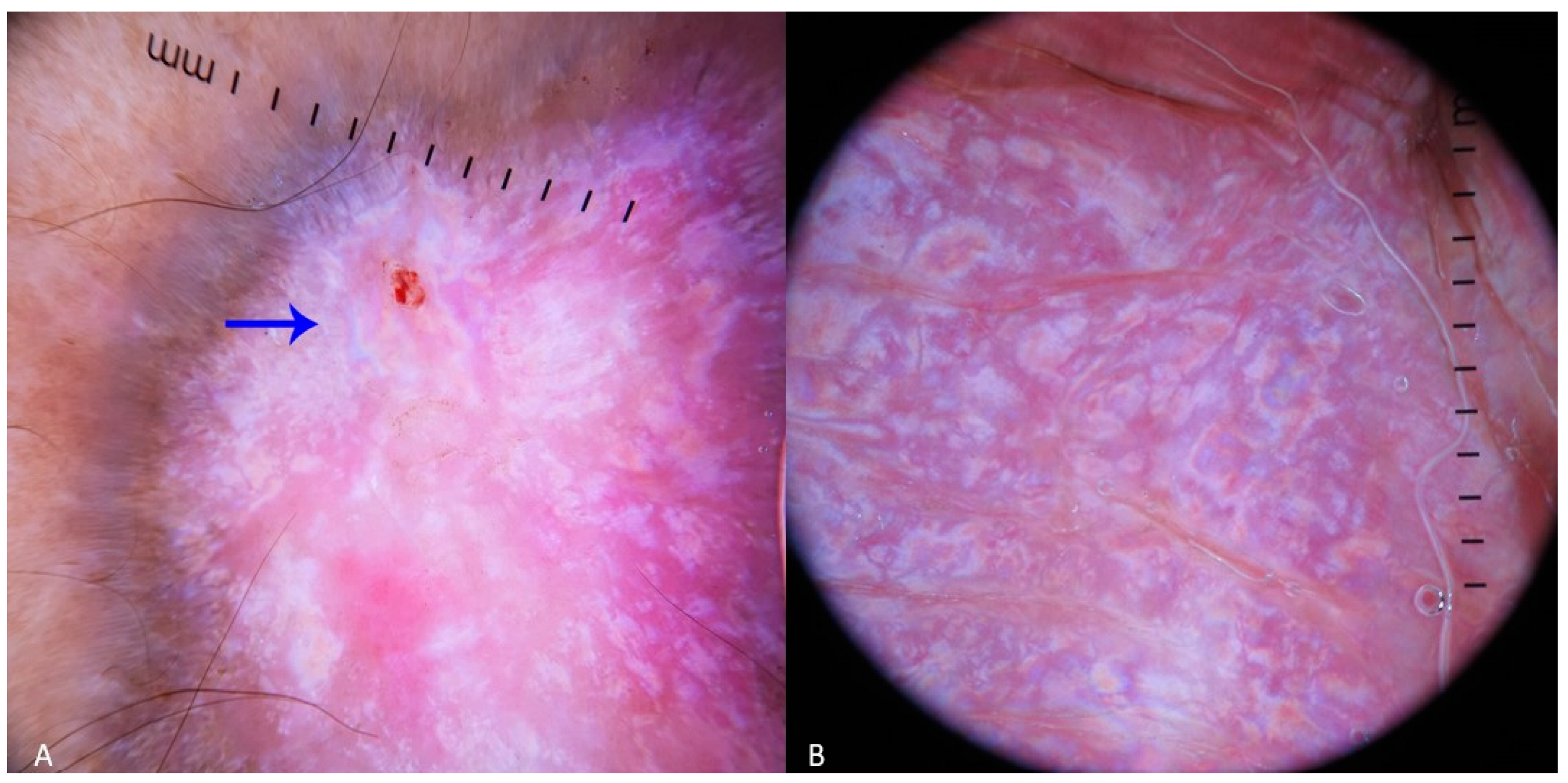 Dermatopathology 11 00035 g003