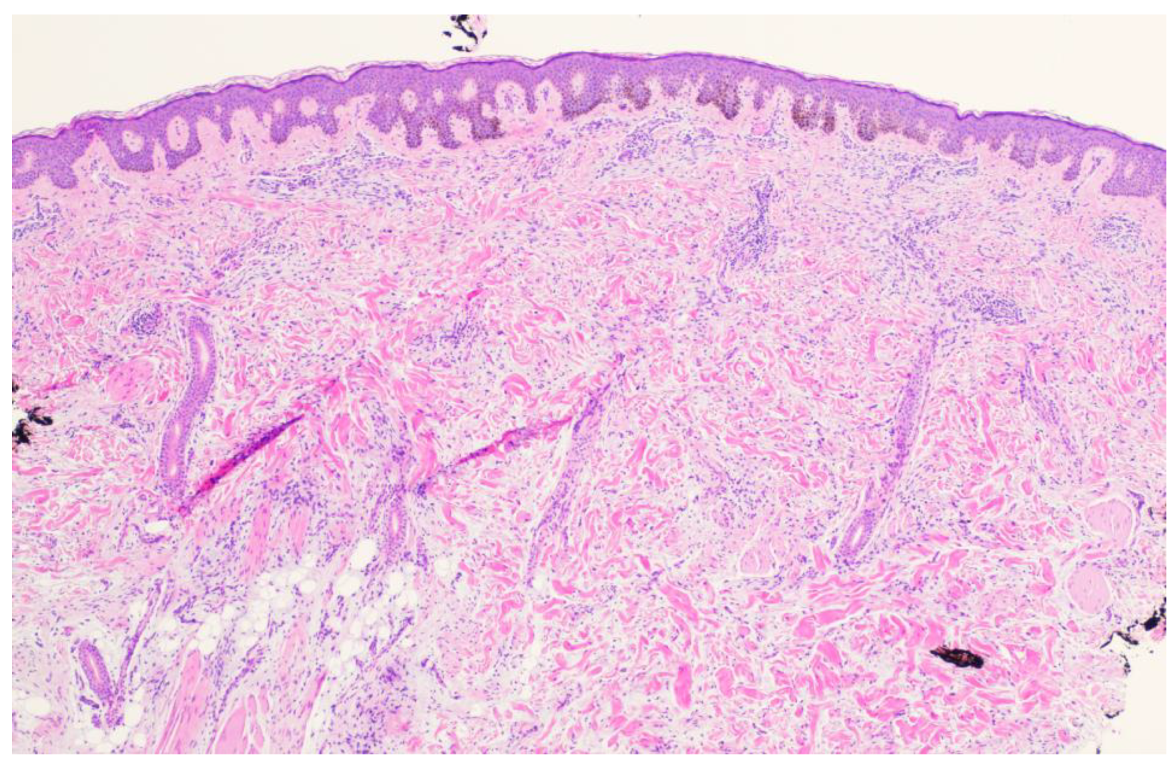 Dermatopathology 11 00036 g003