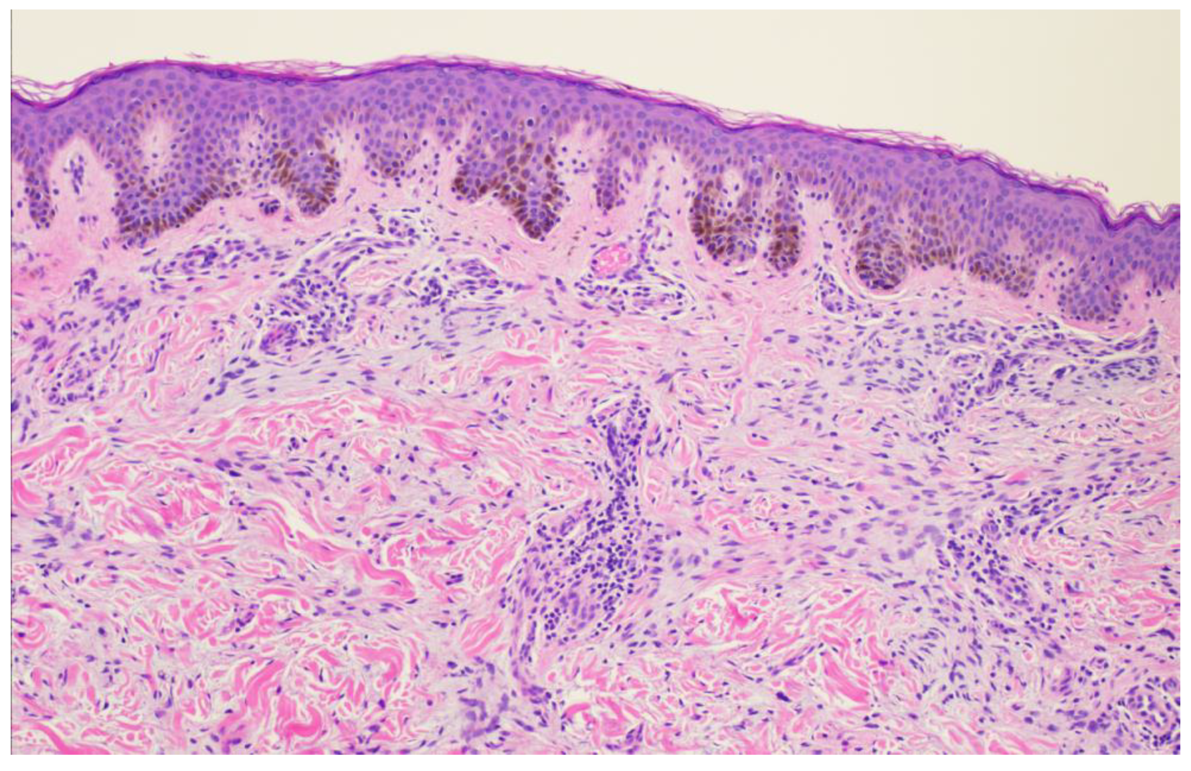 Dermatopathology 11 00036 g004