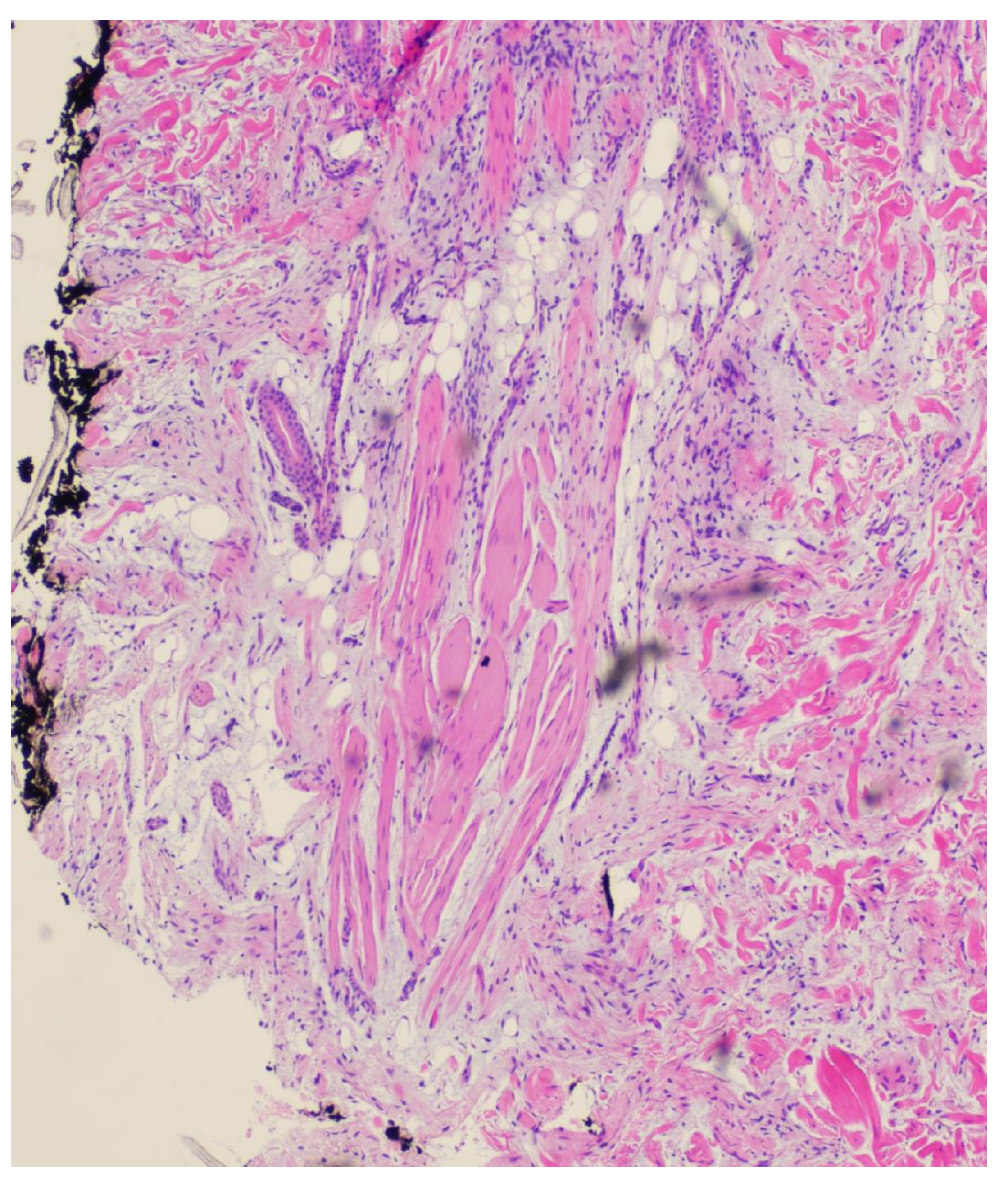 Dermatopathology 11 00036 g005