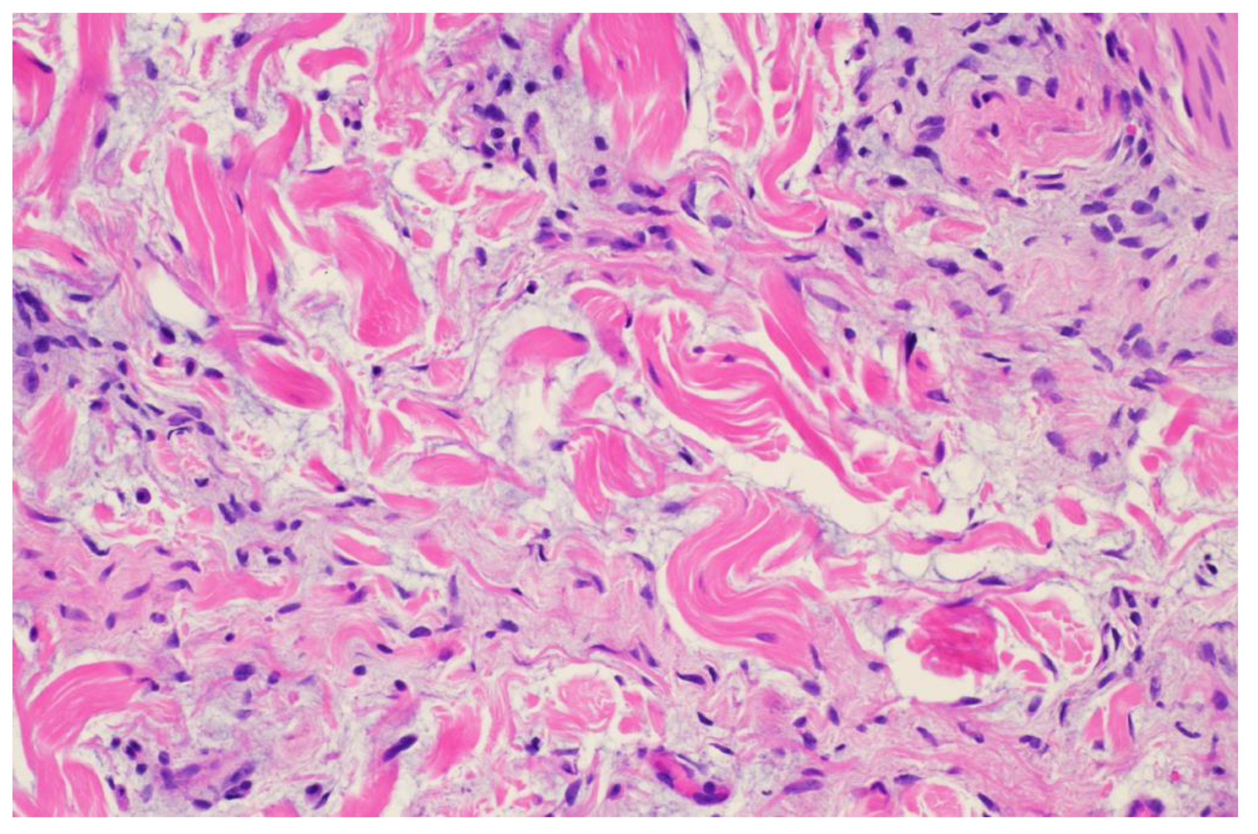 Dermatopathology 11 00036 g006