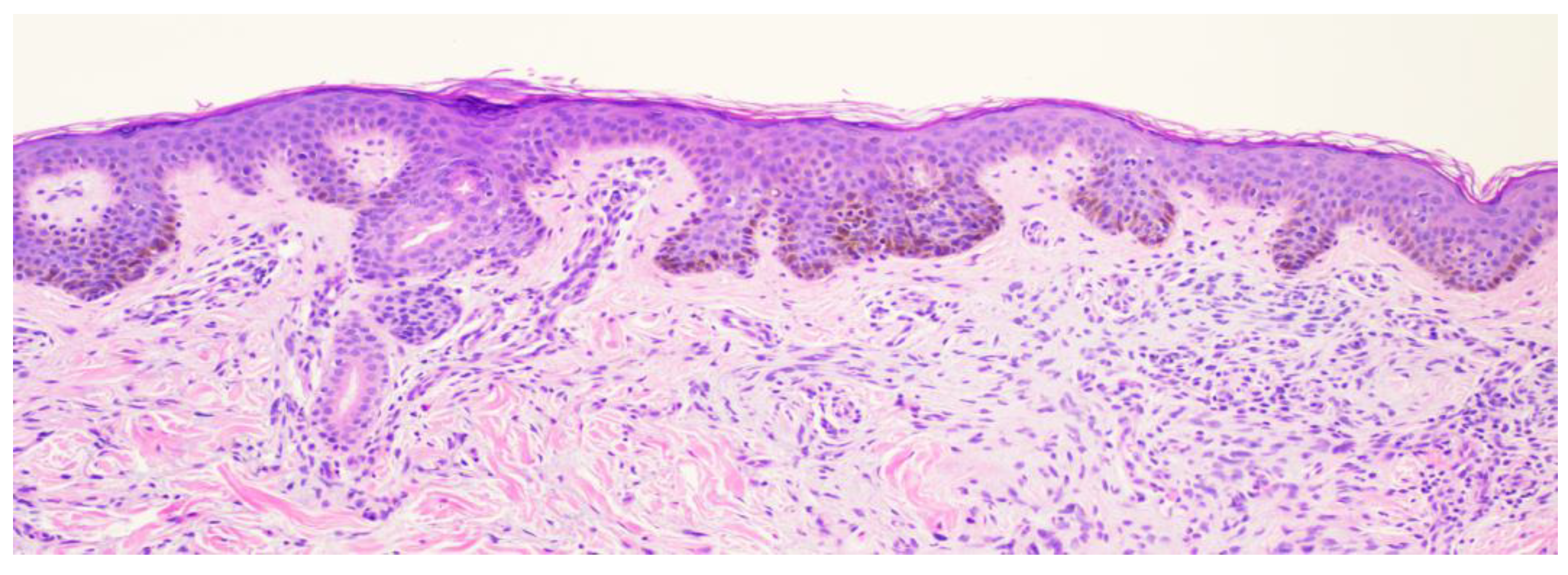Dermatopathology 11 00036 g007