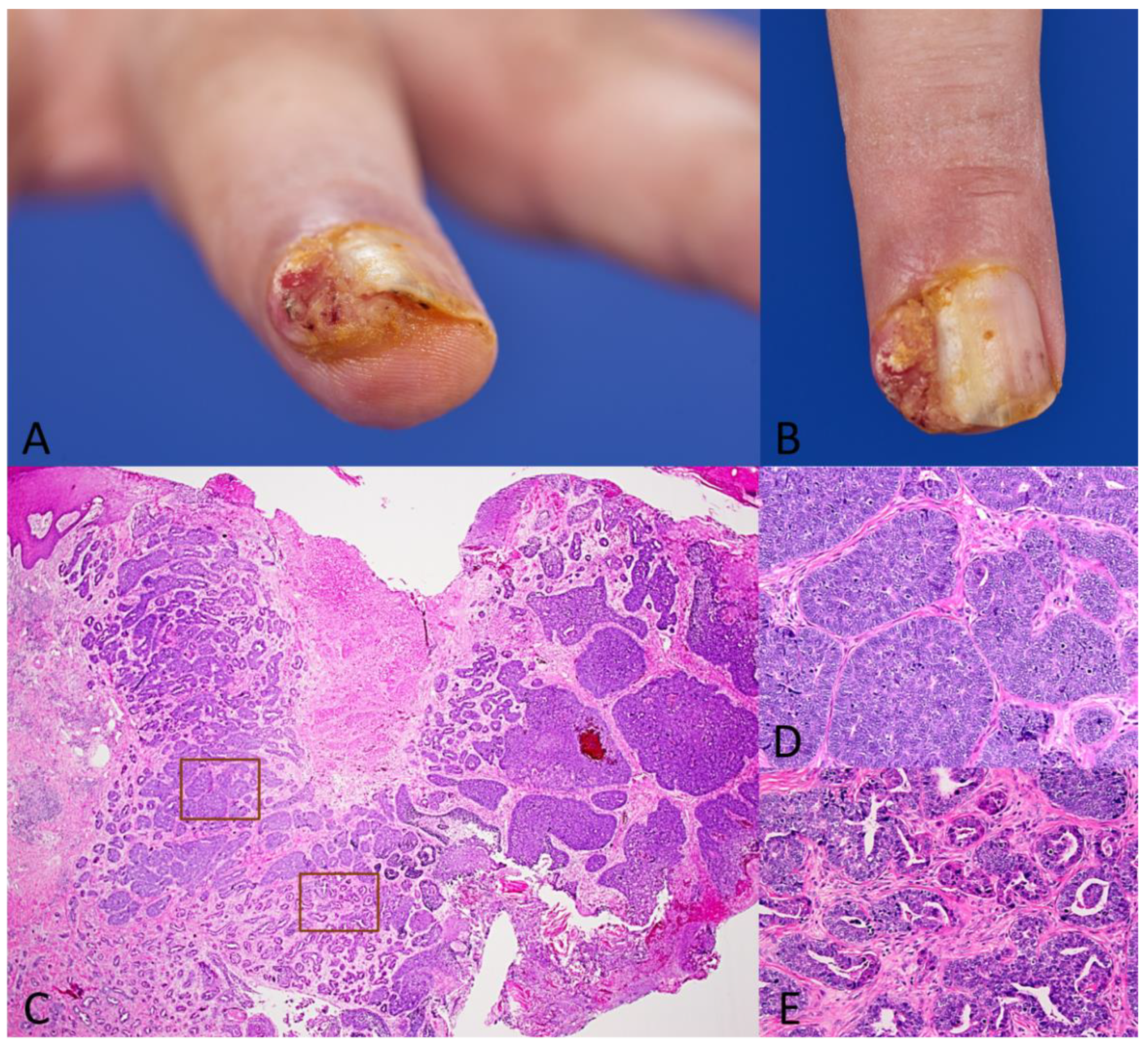 Dermatopathology 11 00037 g001