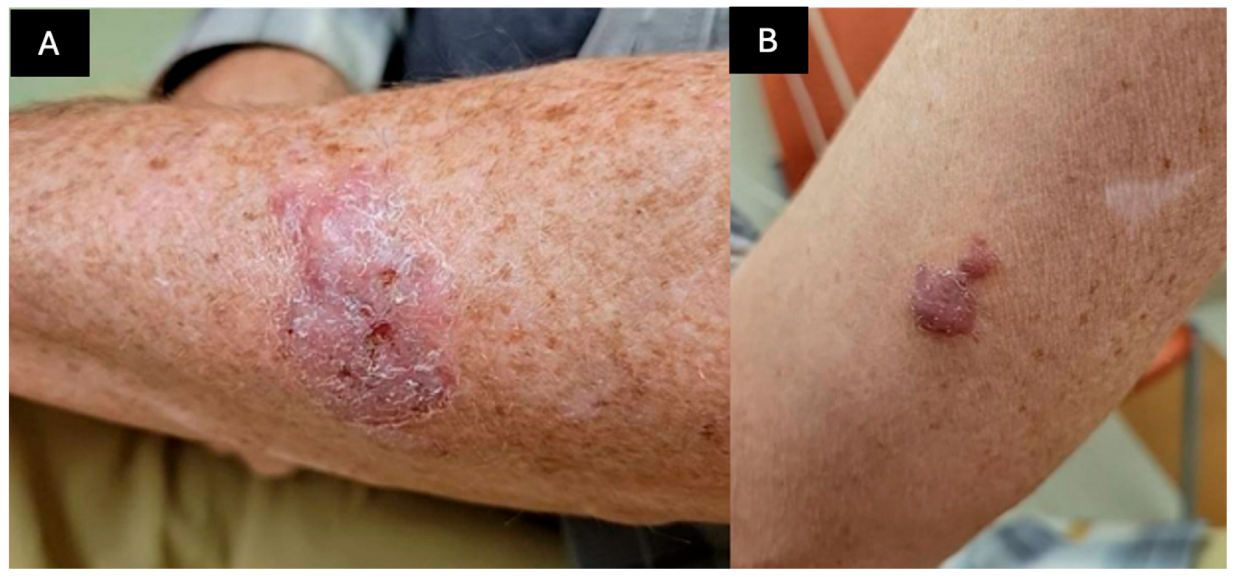 Dermatopathology 12 00002 g001