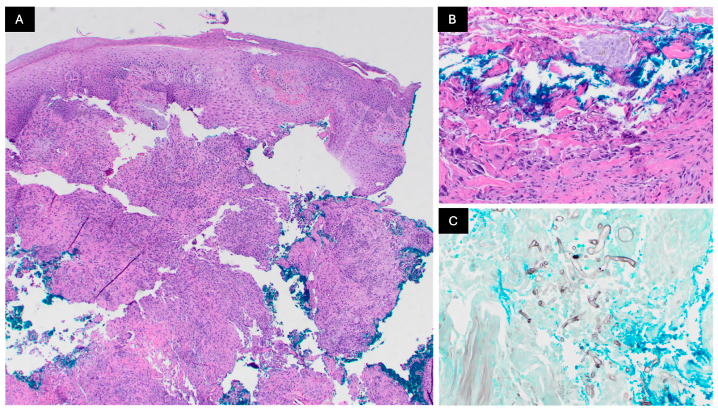 Dermatopathology 12 00002 g002