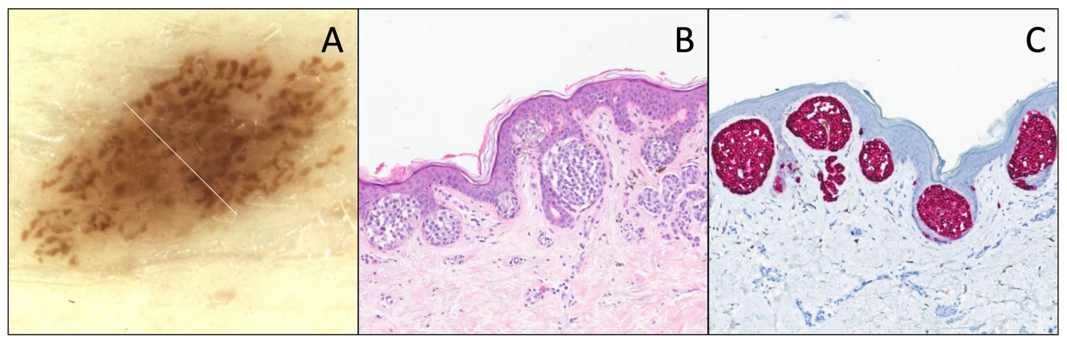 Dermatopathology 12 00003 g004