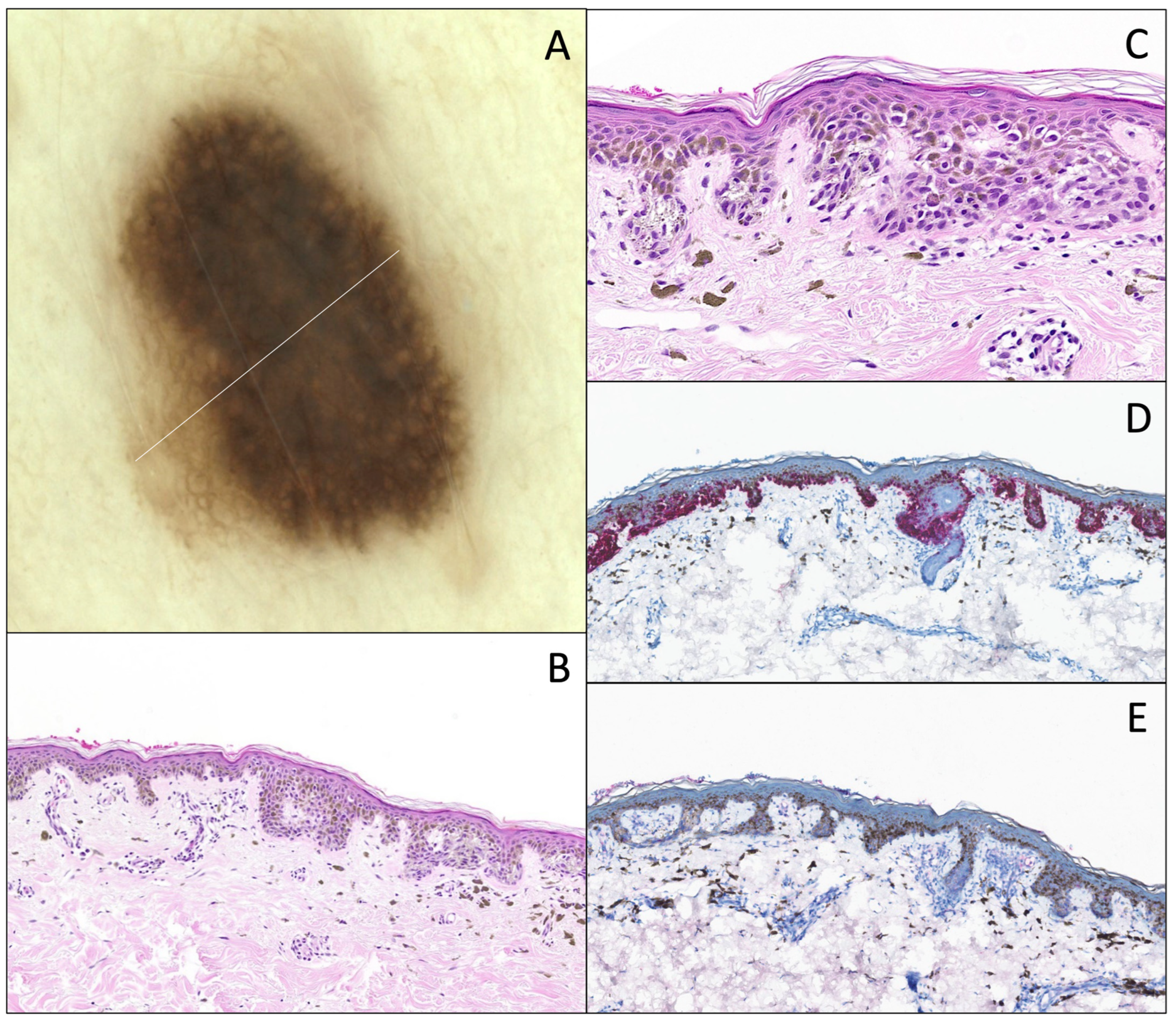 Dermatopathology 12 00003 g005