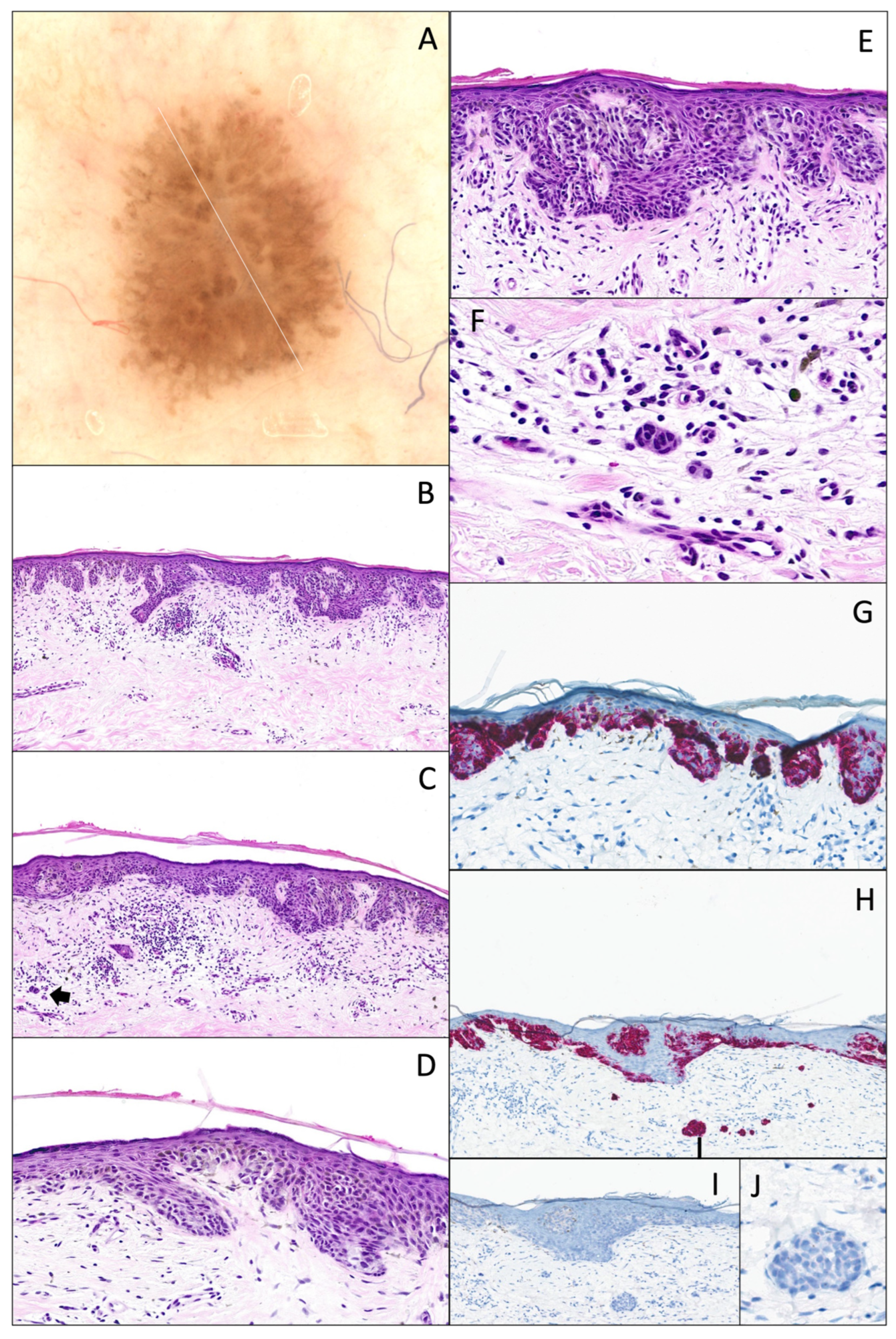Dermatopathology 12 00003 g008