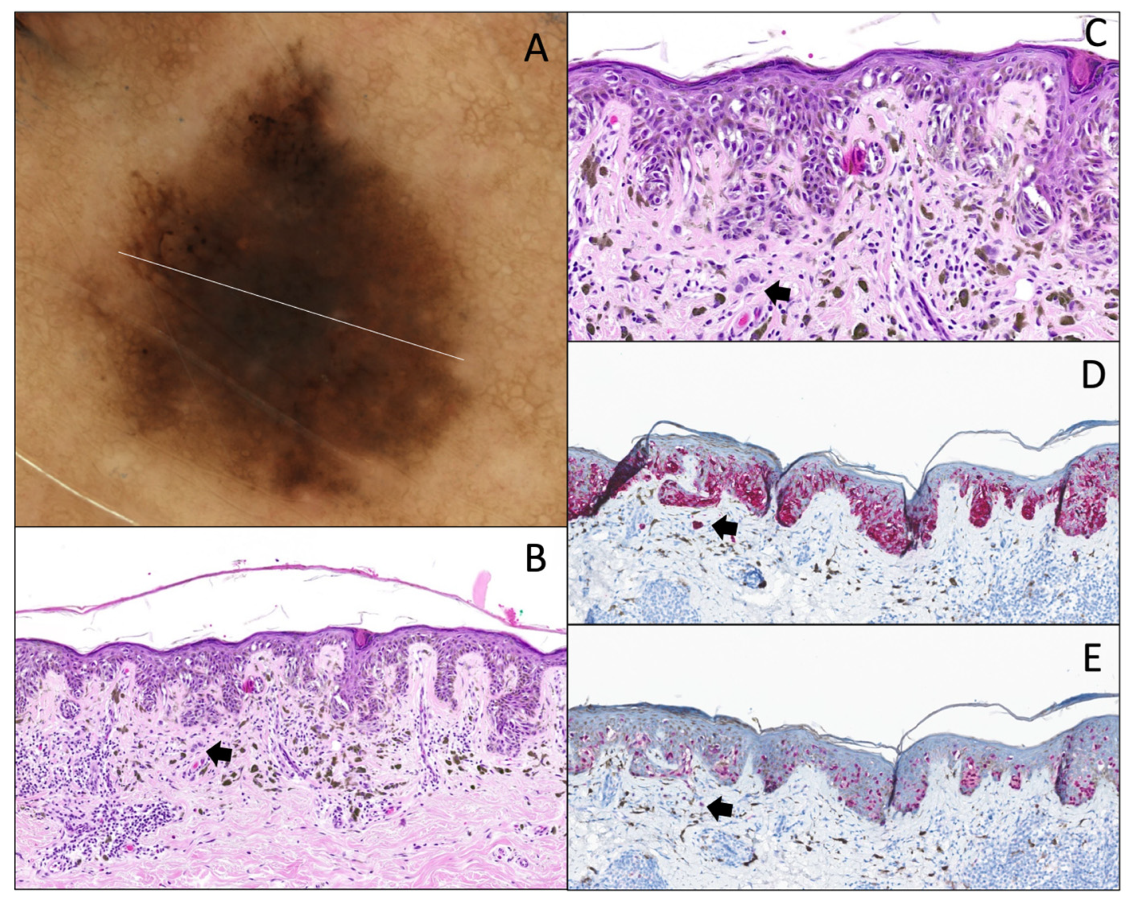 Dermatopathology 12 00003 g010