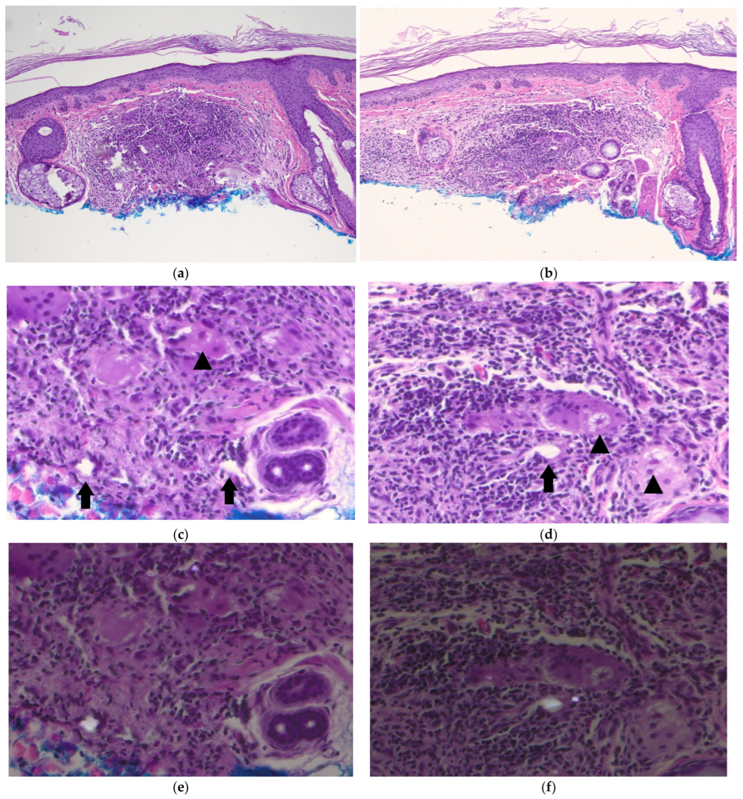 Dermatopathology 12 00004 g002