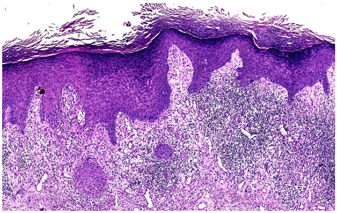 Dermatopathology 12 00008 g003