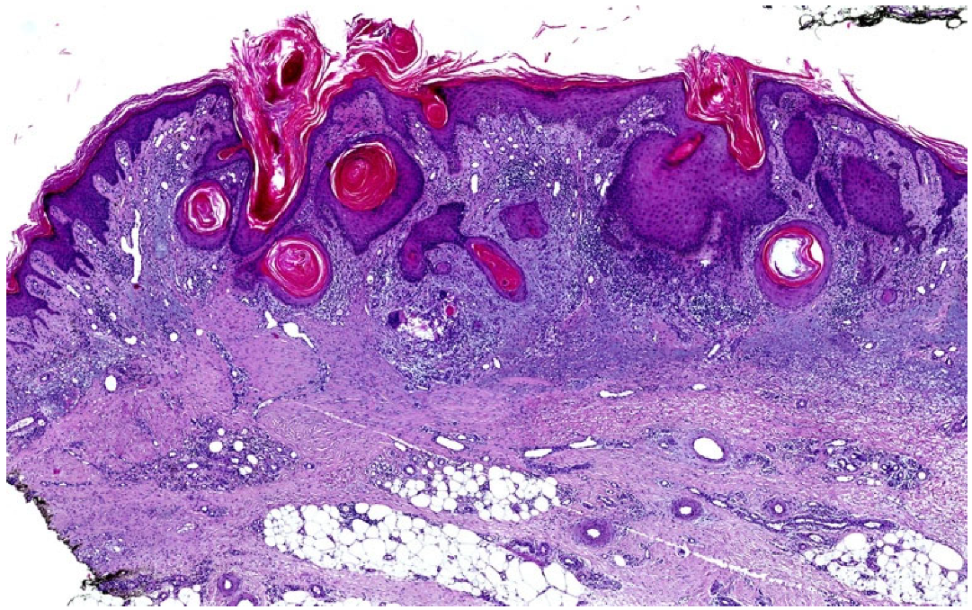 Dermatopathology 12 00008 g004
