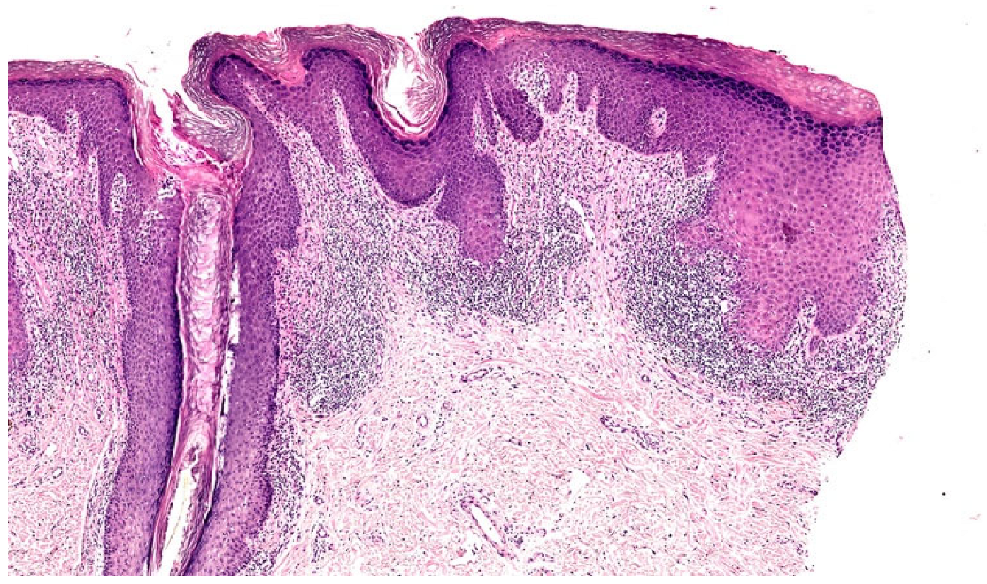 Dermatopathology 12 00008 g005
