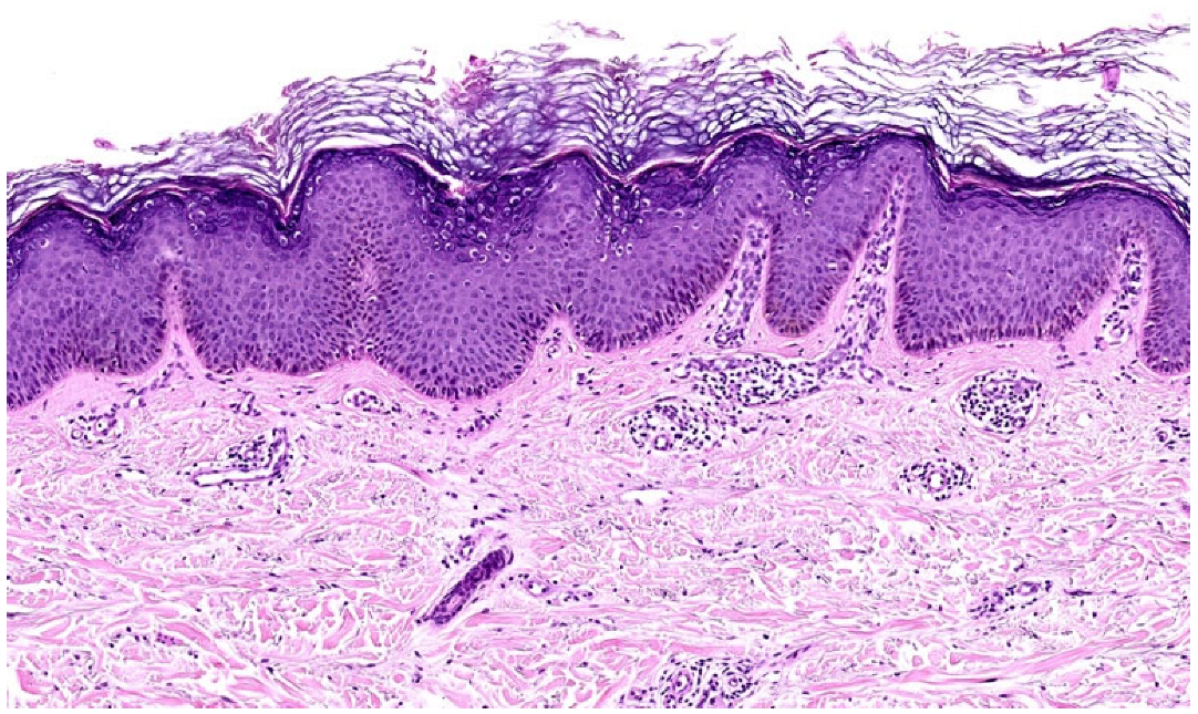 Dermatopathology 12 00008 g007