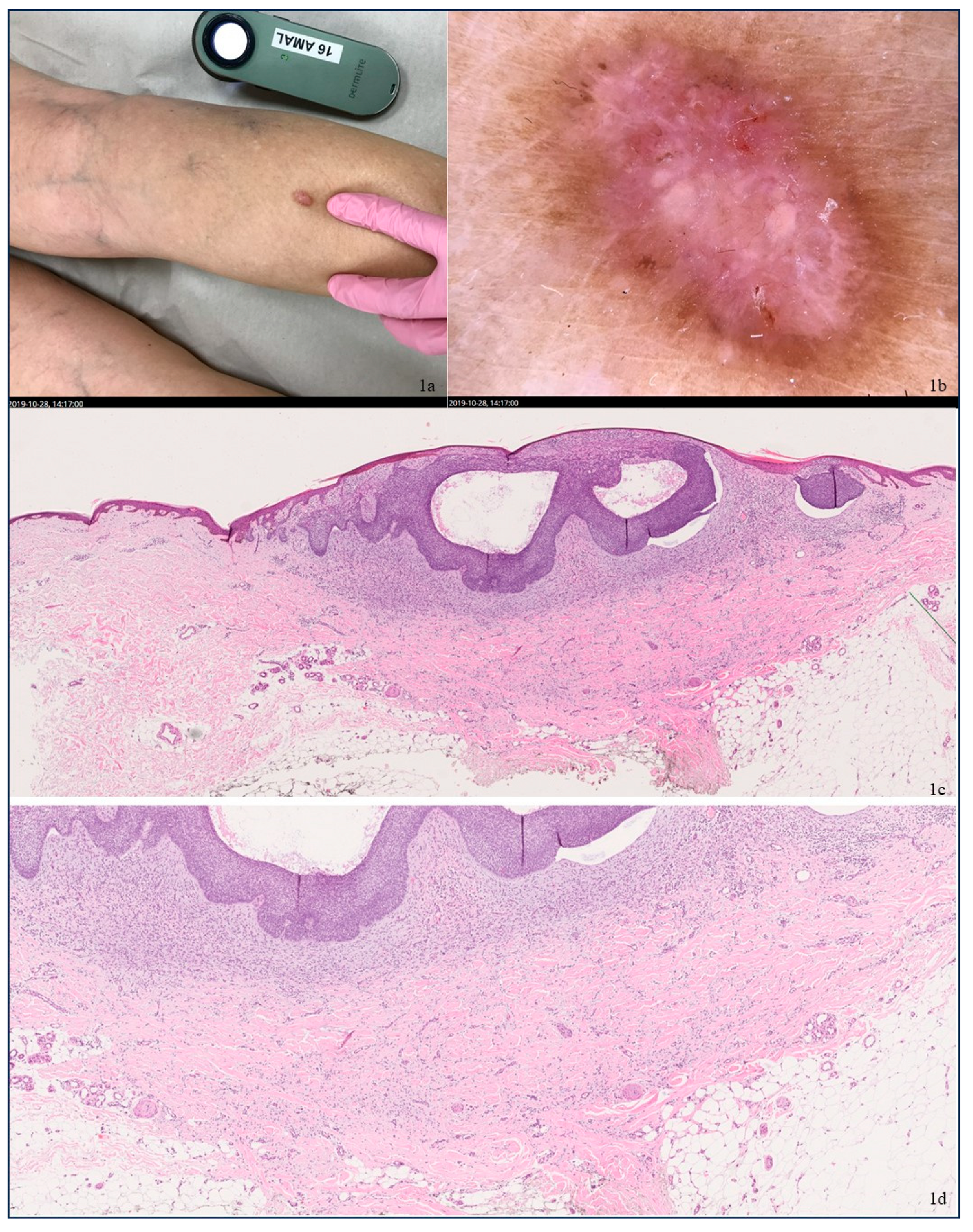 Dermatopathology 12 00010 g001