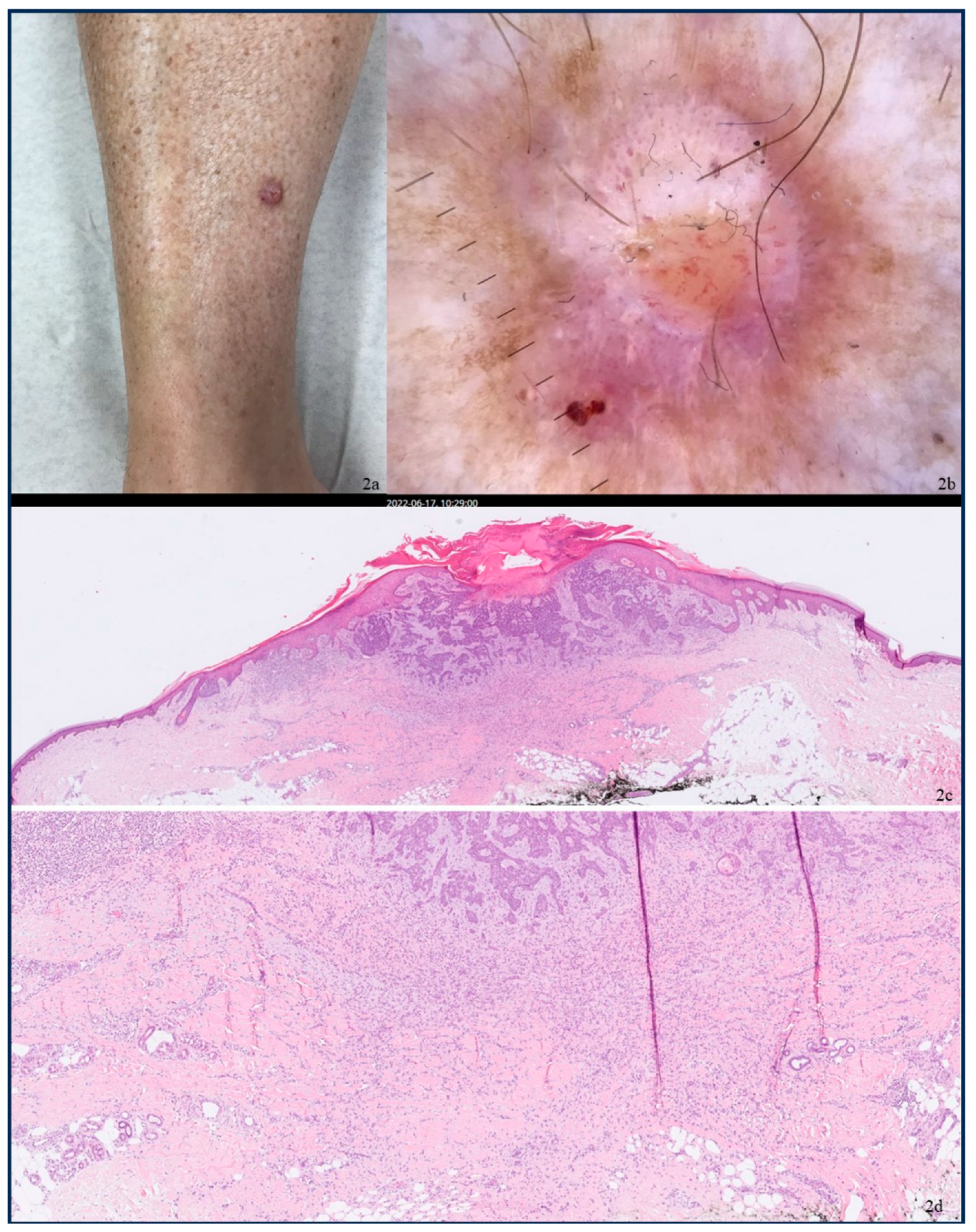 Dermatopathology 12 00010 g002