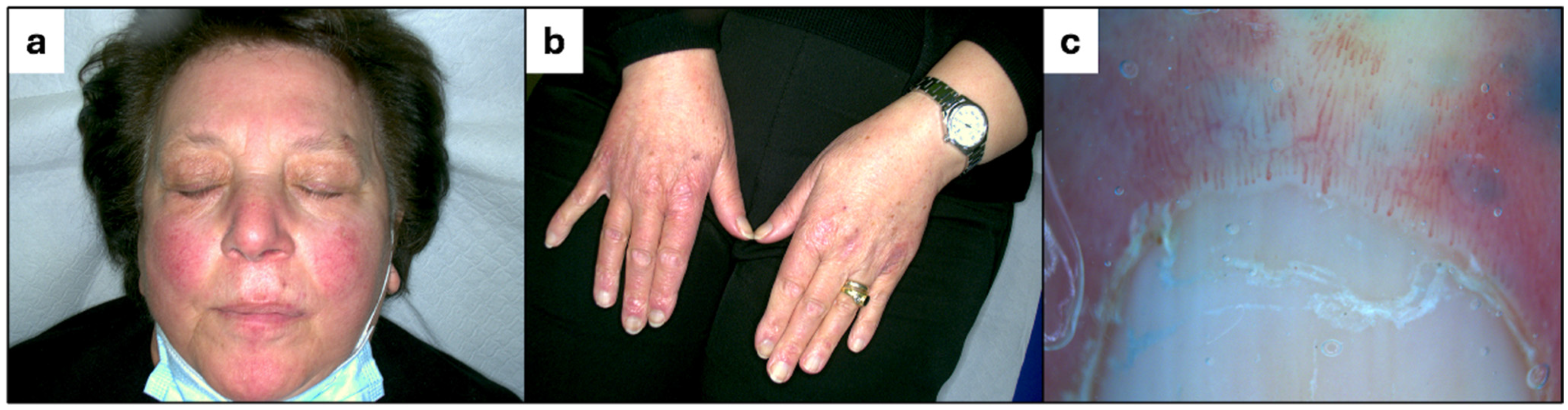 Dermatopathology 12 00011 g001