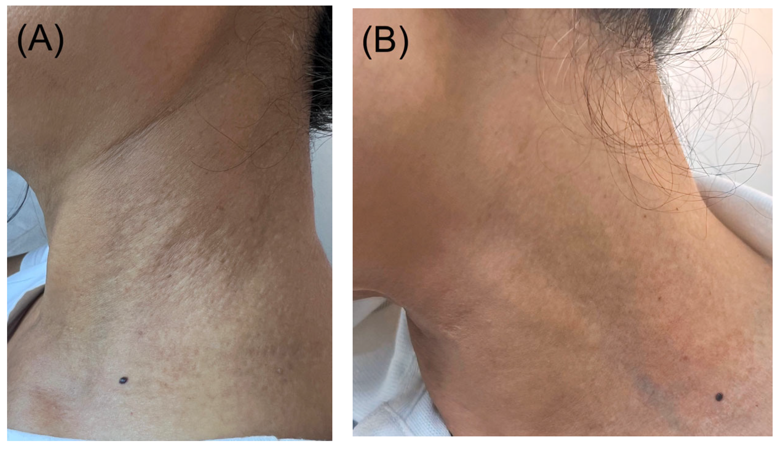 Dermatopathology 12 00015 g001