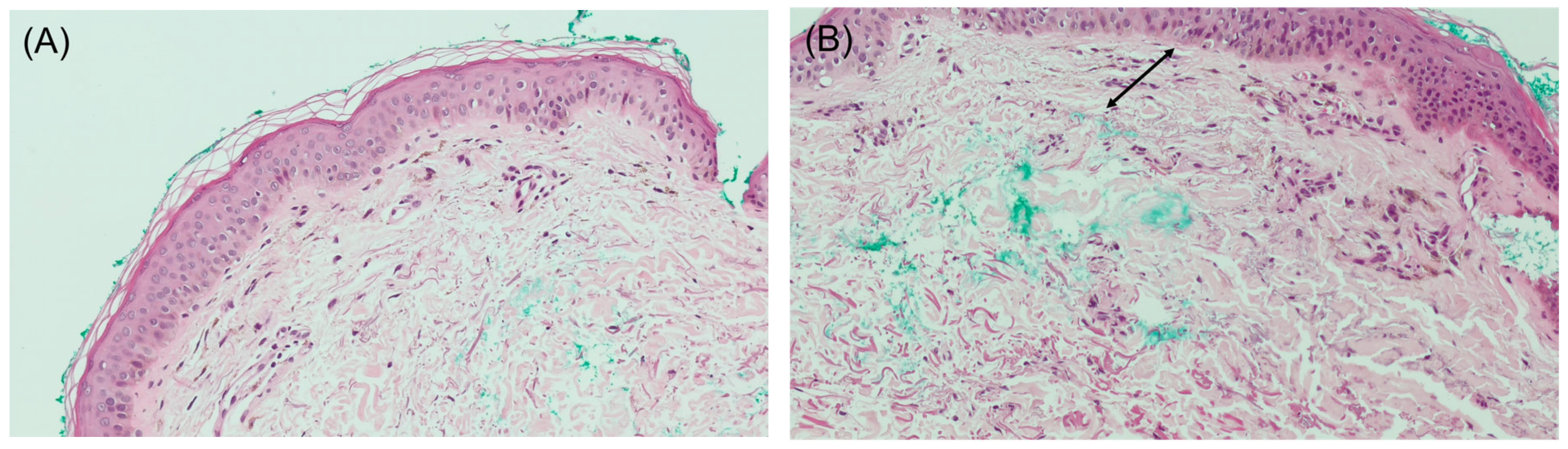 Dermatopathology 12 00015 g002