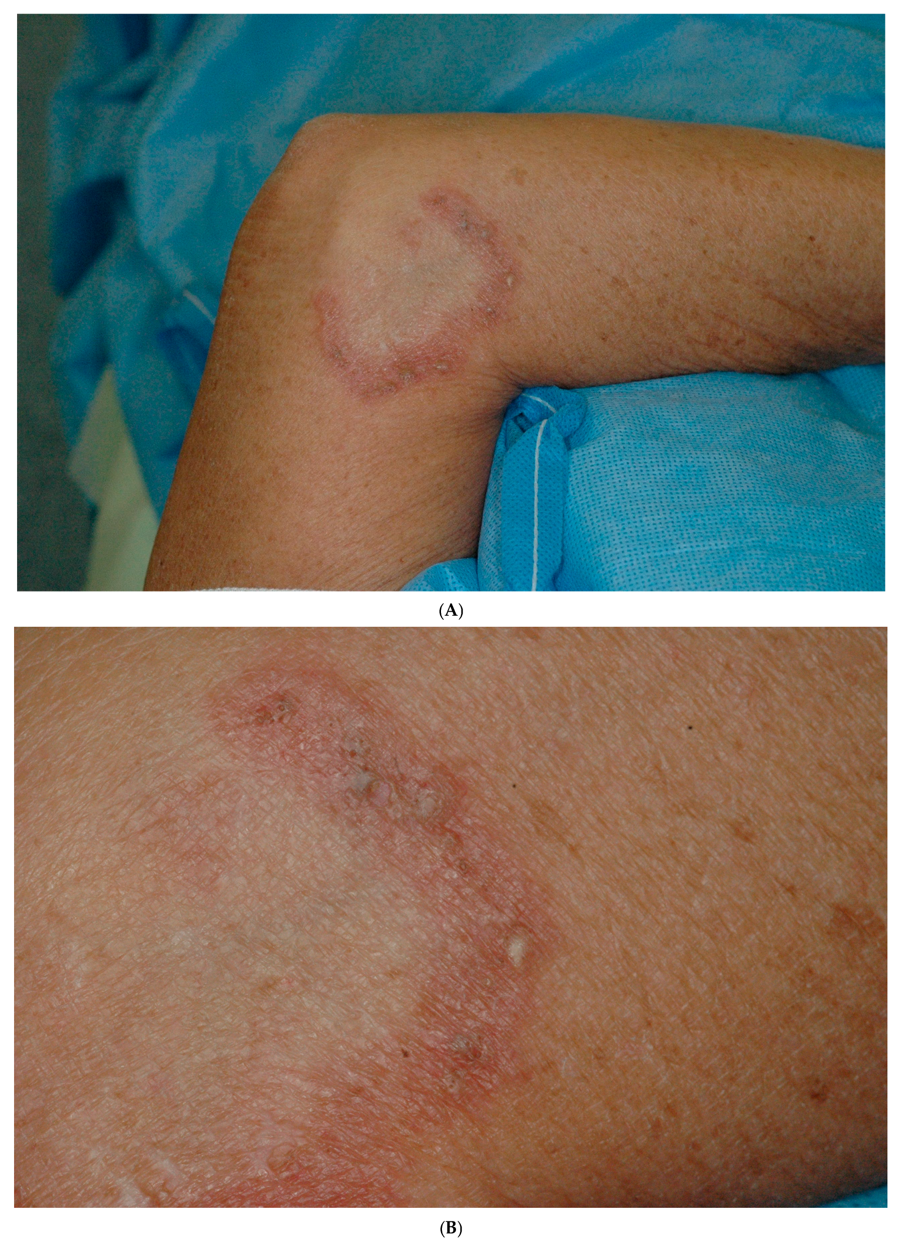 Dermatopathology 12 00016 g001a