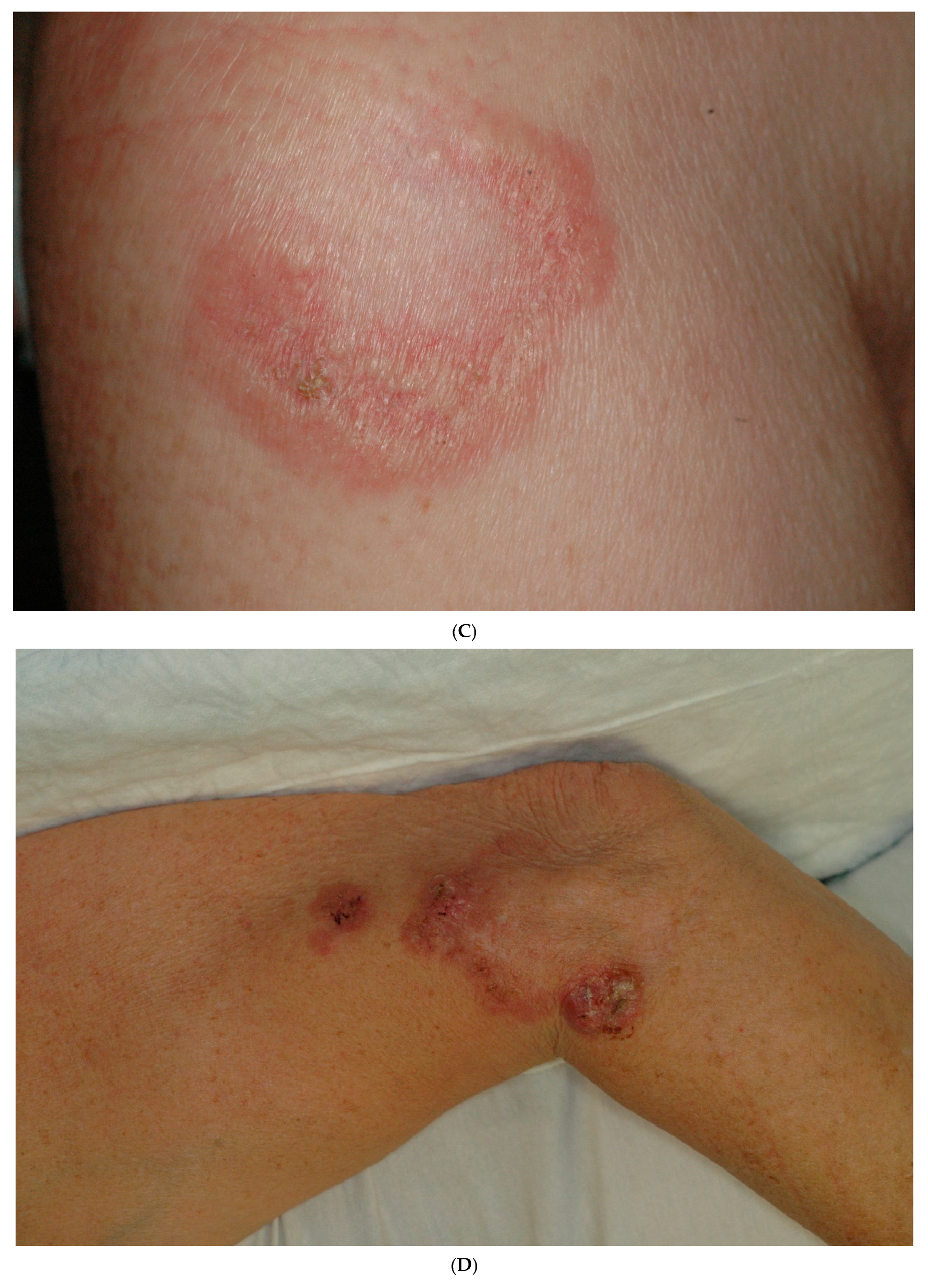 Dermatopathology 12 00016 g001b