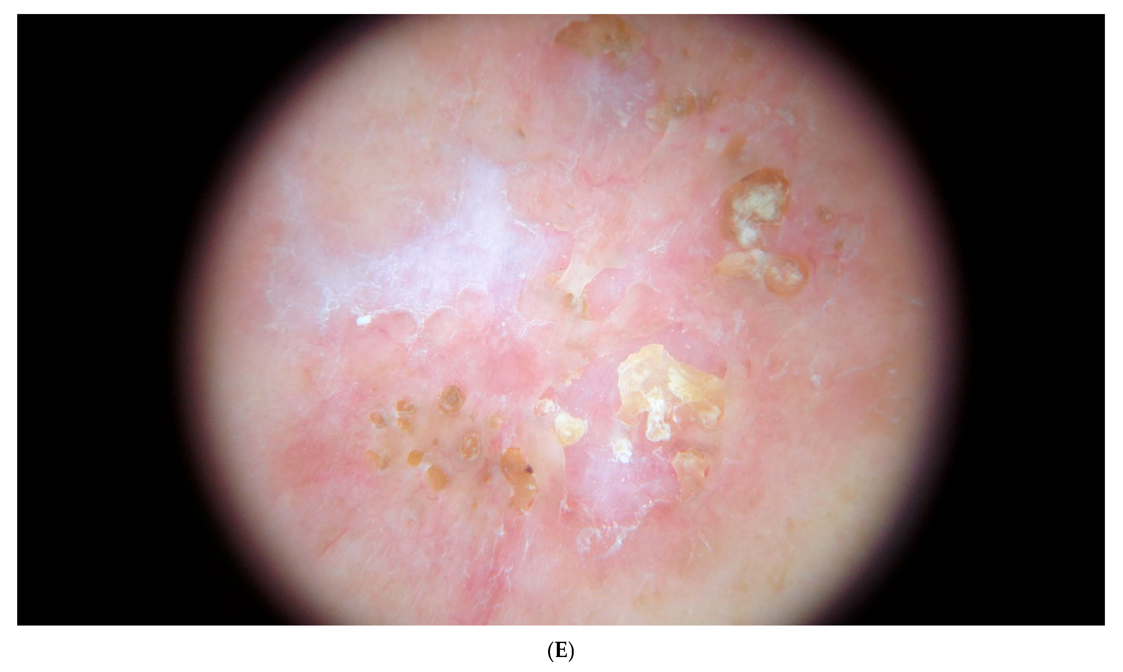 Dermatopathology 12 00016 g001c