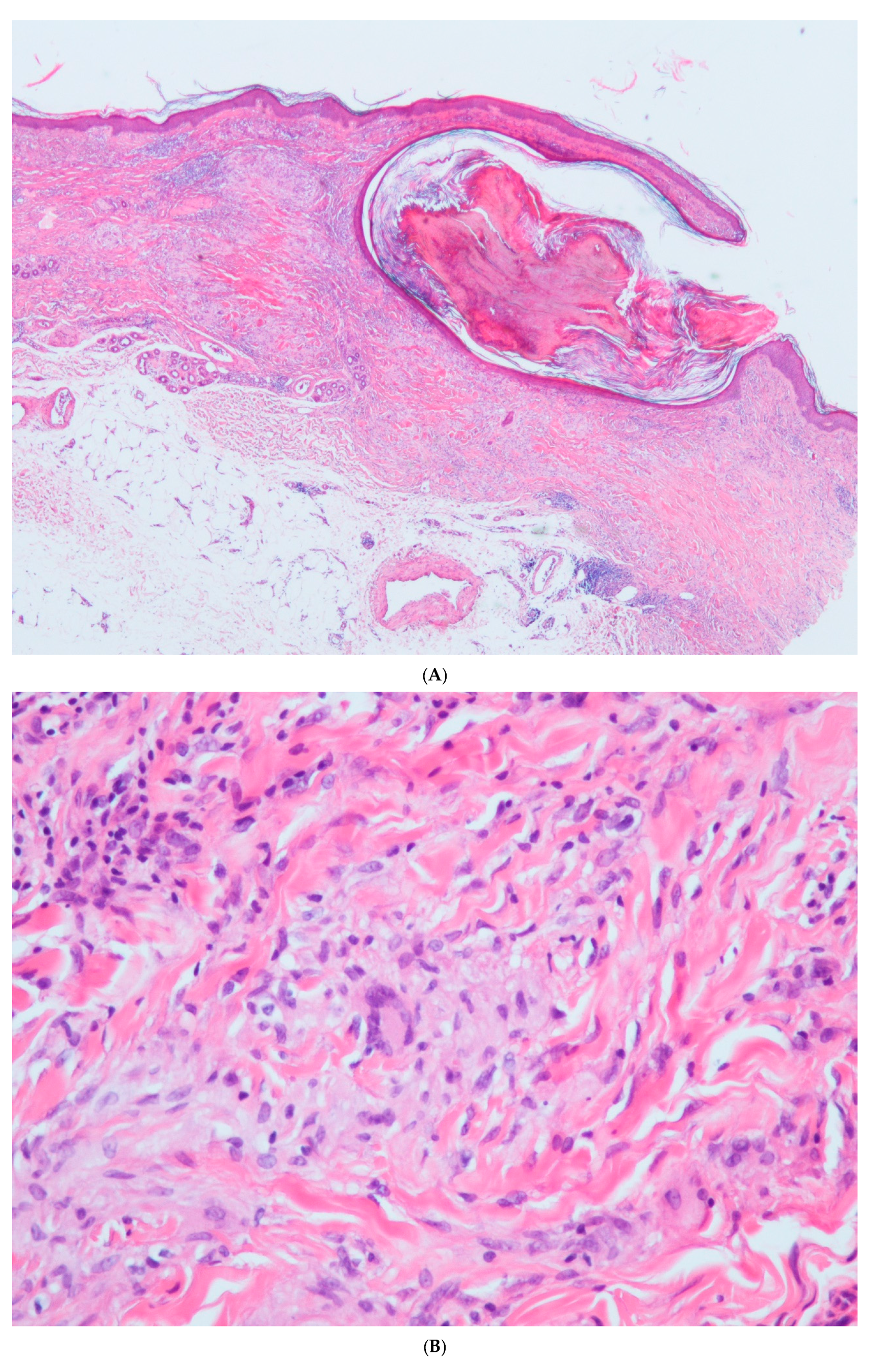 Dermatopathology 12 00016 g002a
