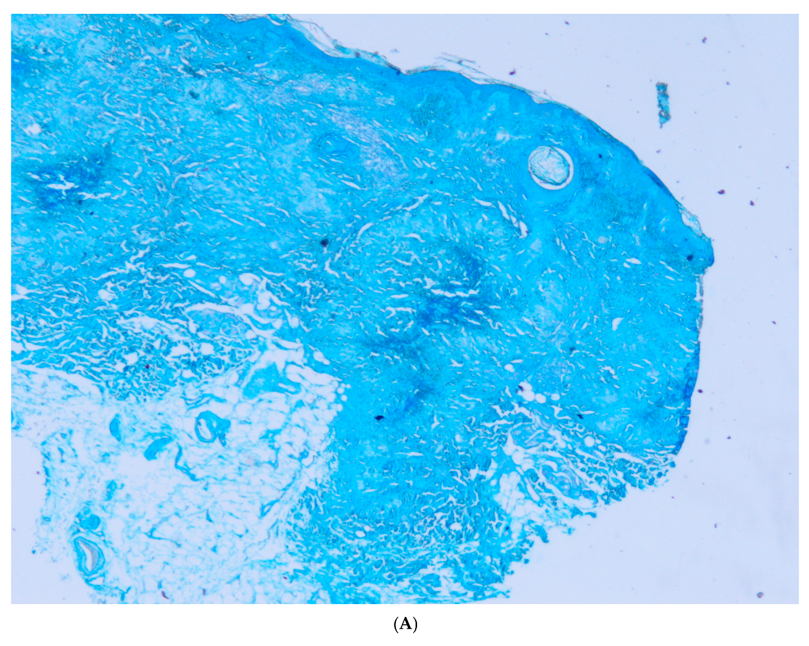 Dermatopathology 12 00016 g003a