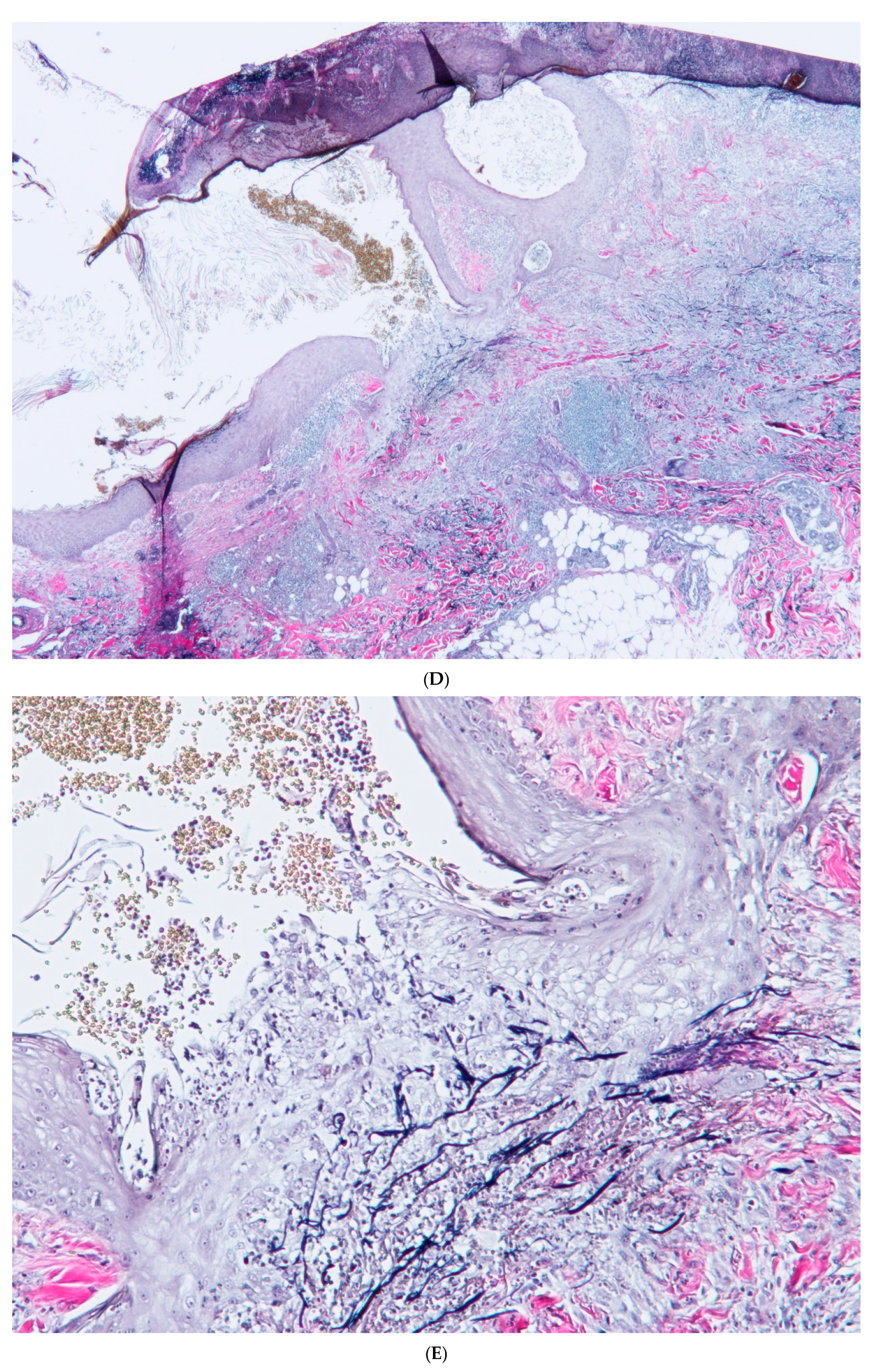 Dermatopathology 12 00016 g003c