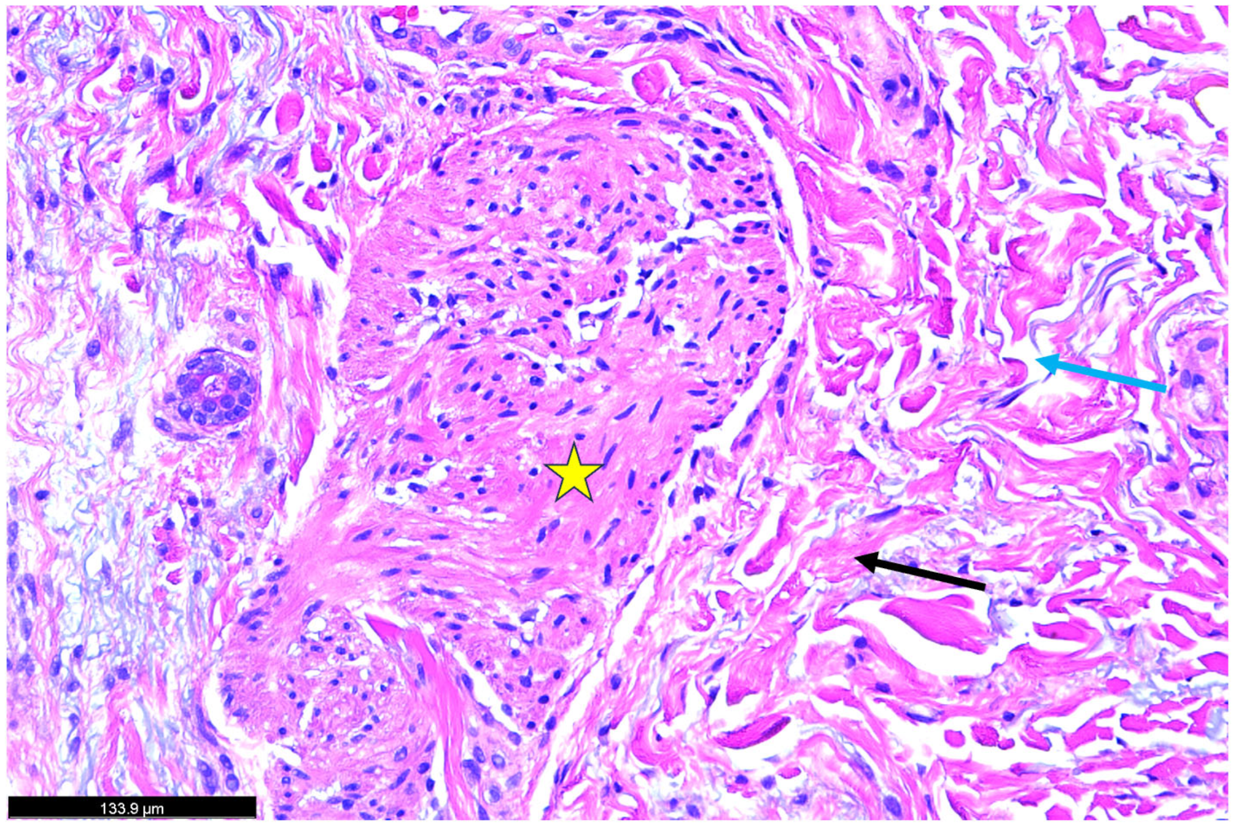 Dermatopathology 12 00017 g004