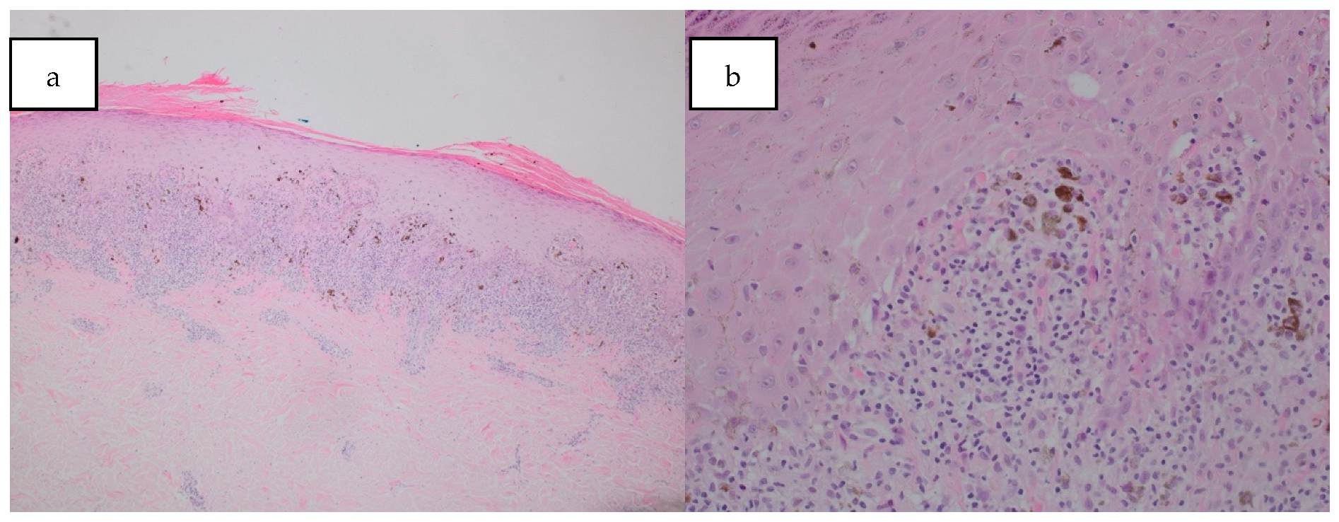 Dermatopathology 12 00021 g002