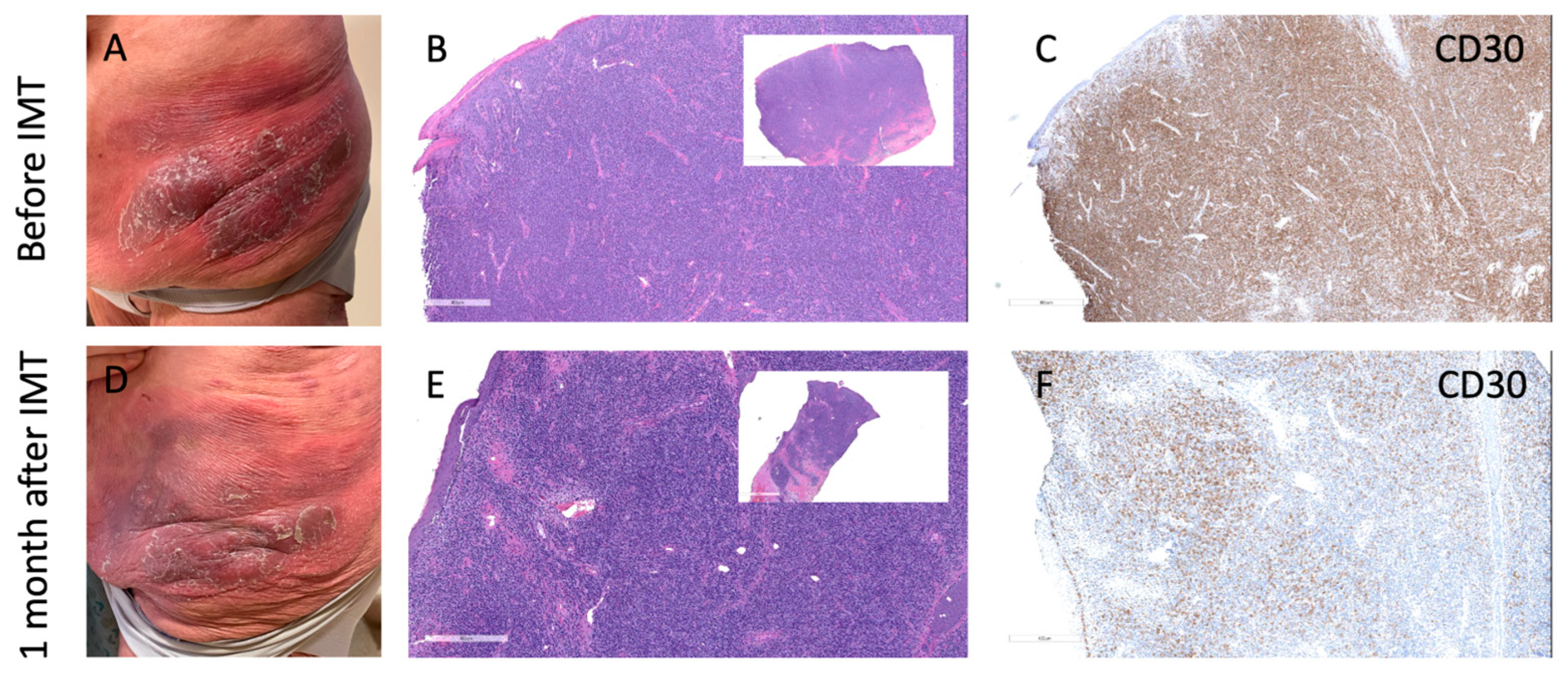 Dermatopathology 12 00022 g001