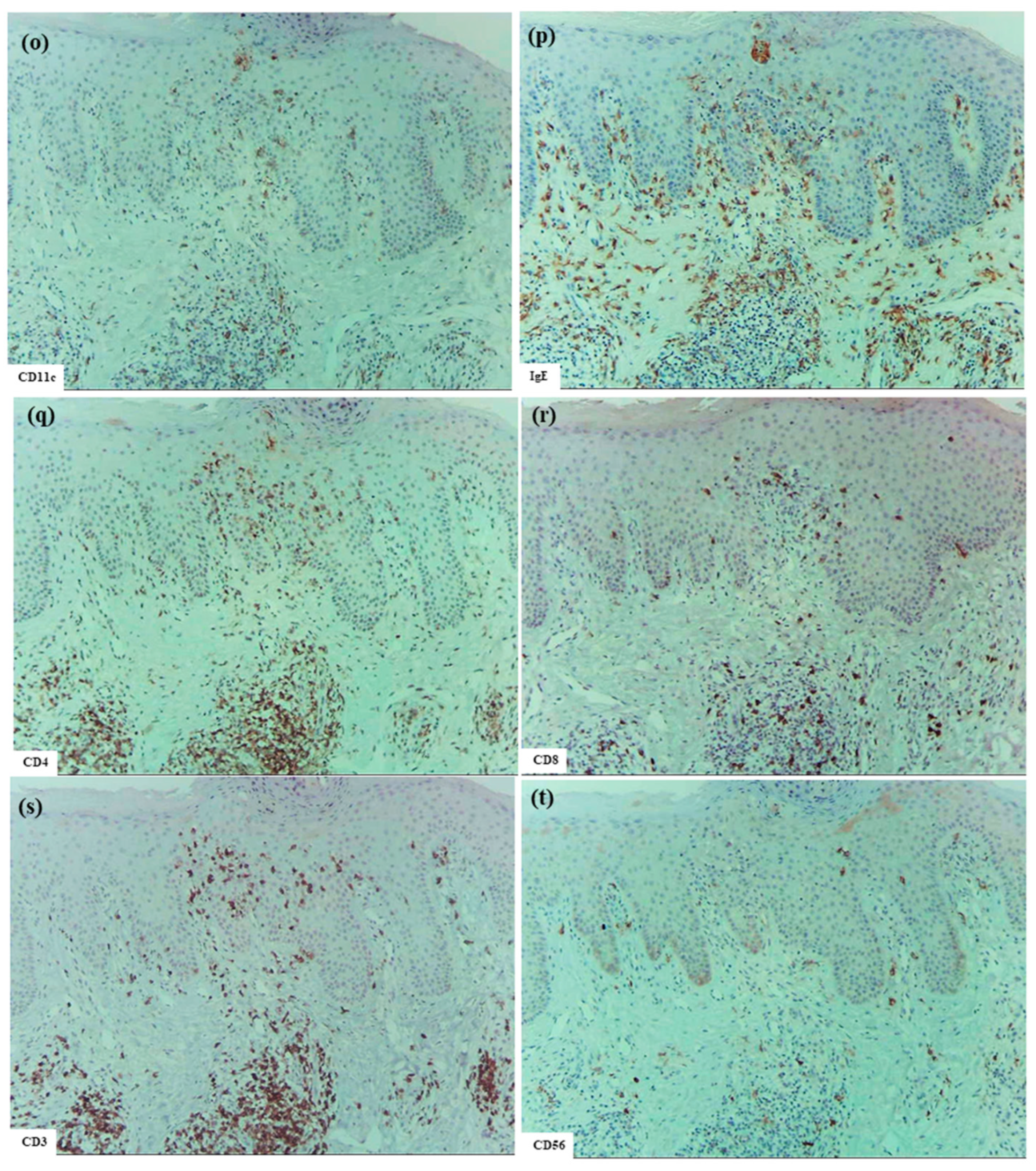 Dermatopathology 12 00023 g001c