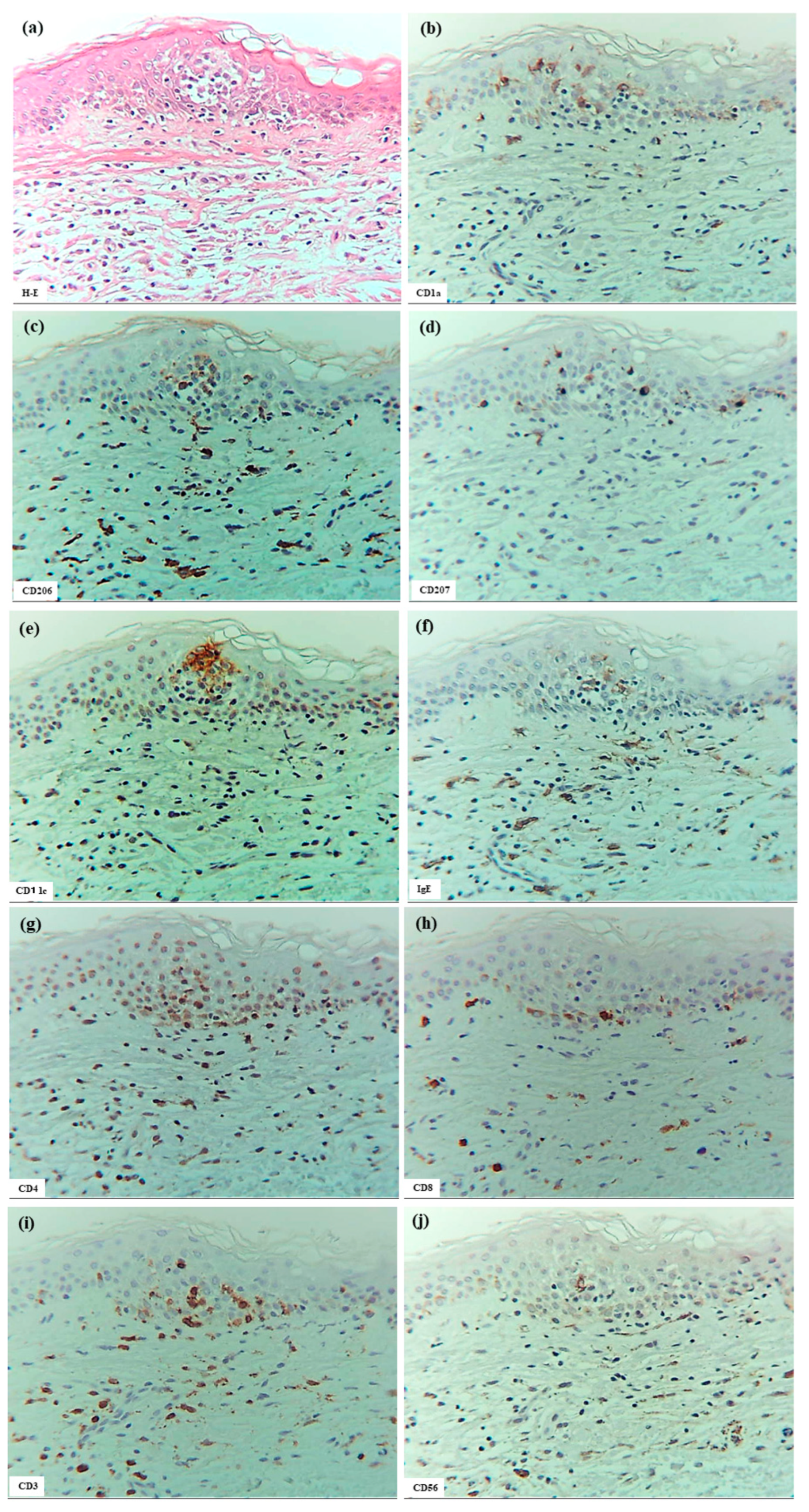 Dermatopathology 12 00023 g003a