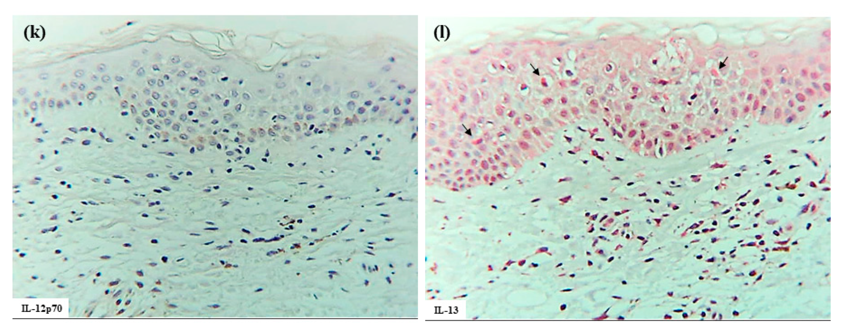 Dermatopathology 12 00023 g003b