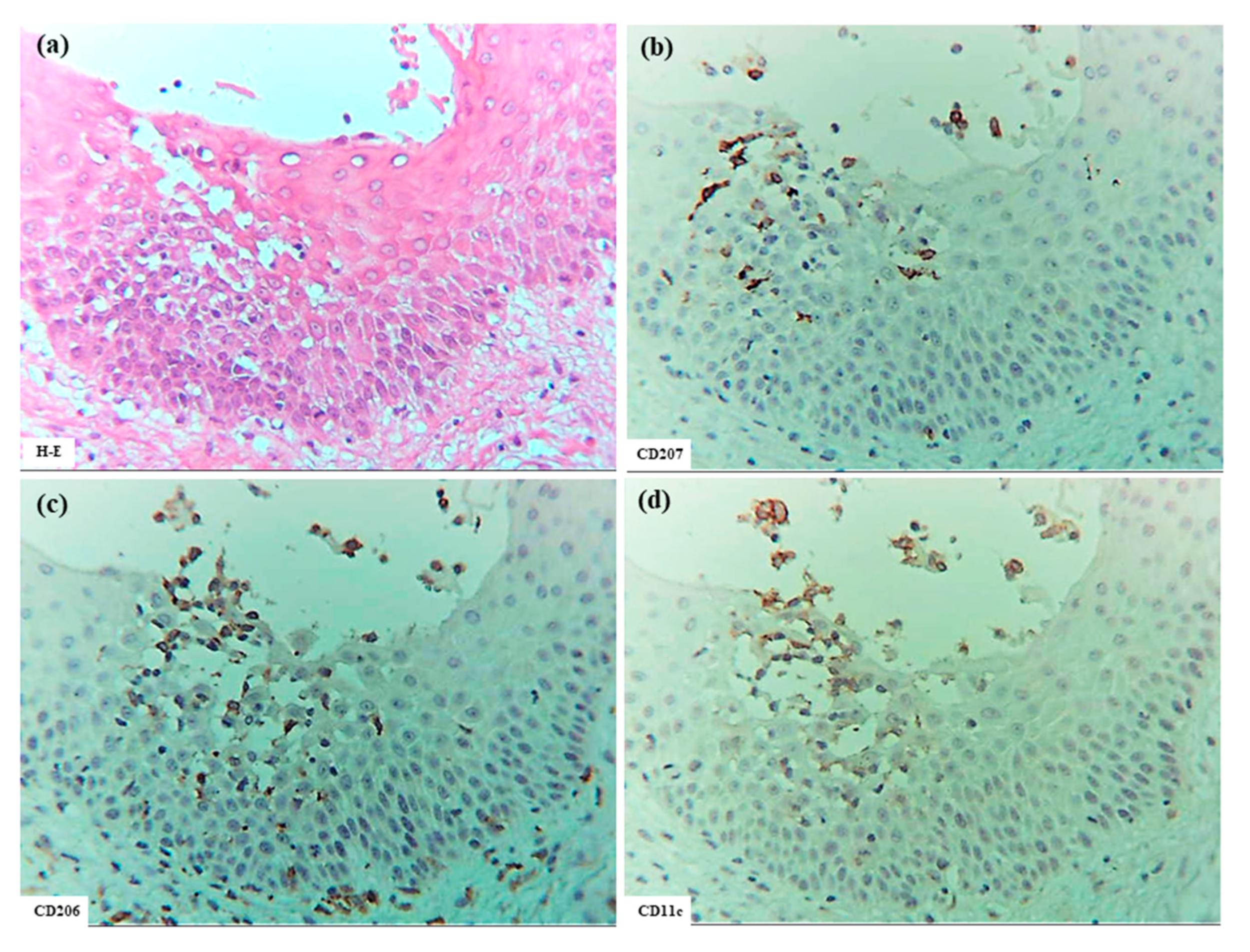 Dermatopathology 12 00023 g006a