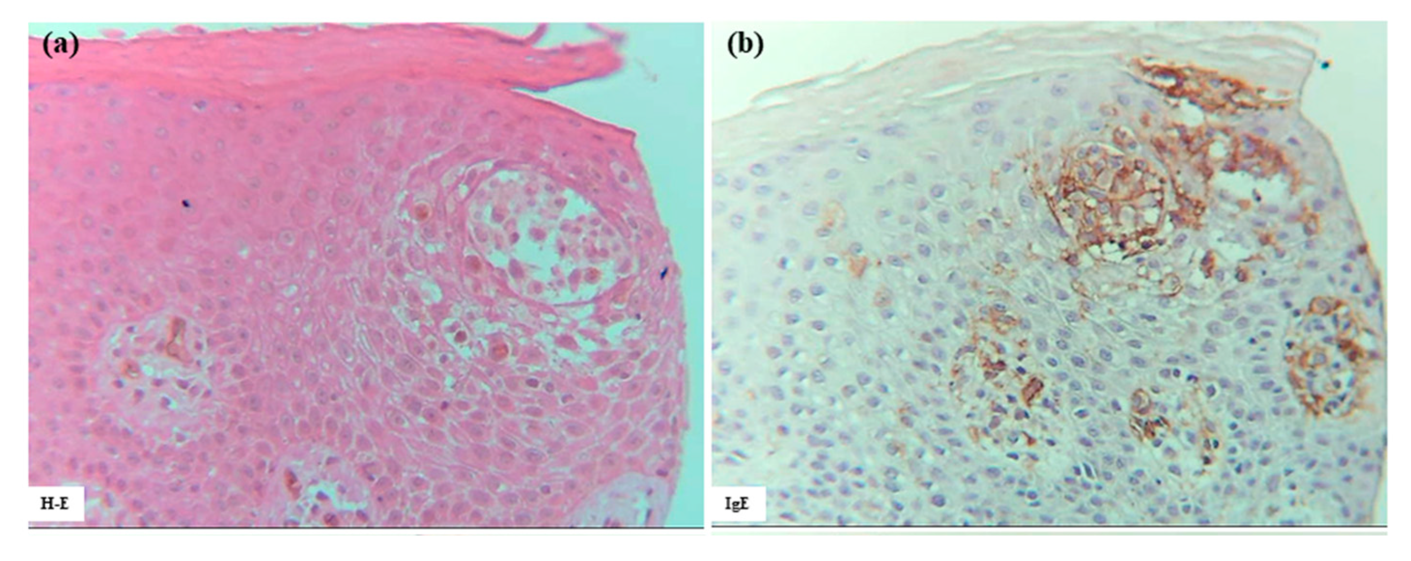 Dermatopathology 12 00023 g007a