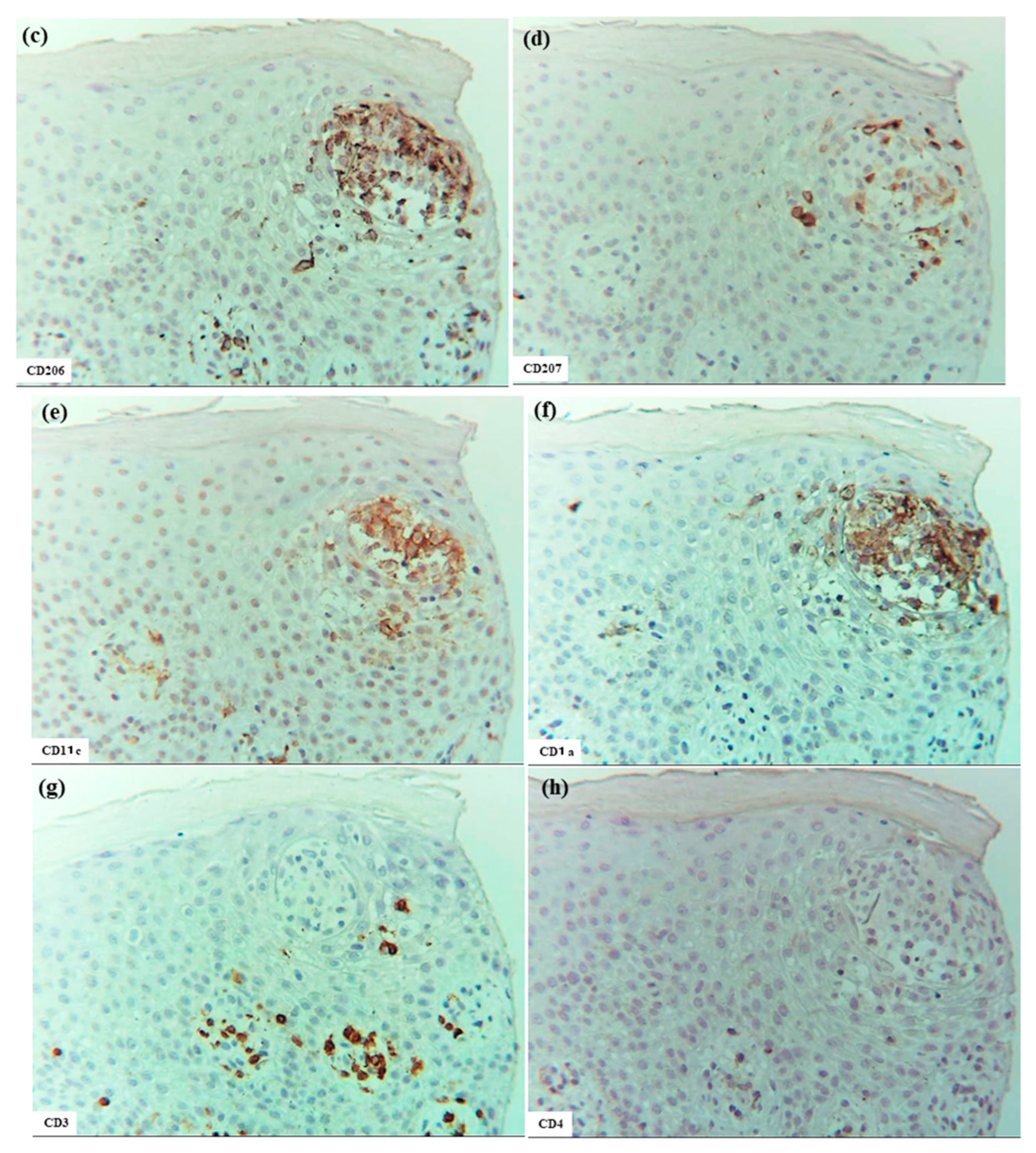Dermatopathology 12 00023 g007b