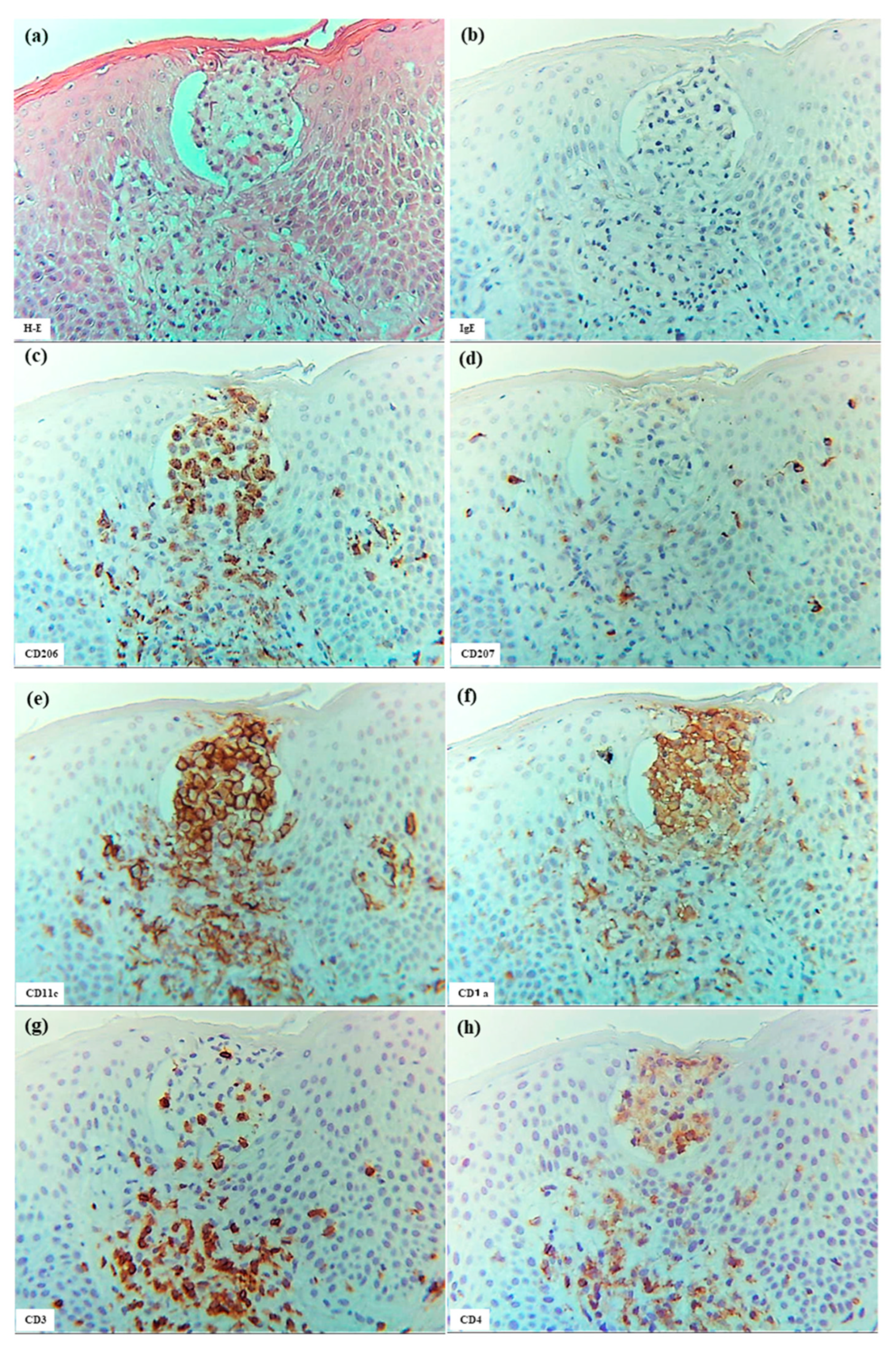 Dermatopathology 12 00023 g008a