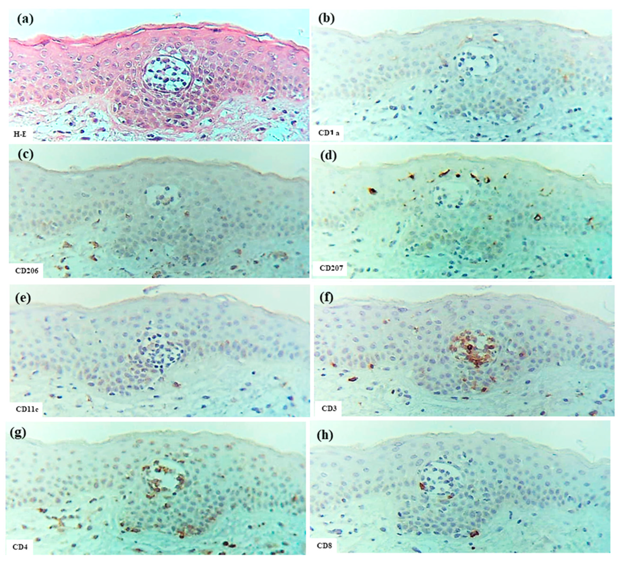 Dermatopathology 12 00023 g009