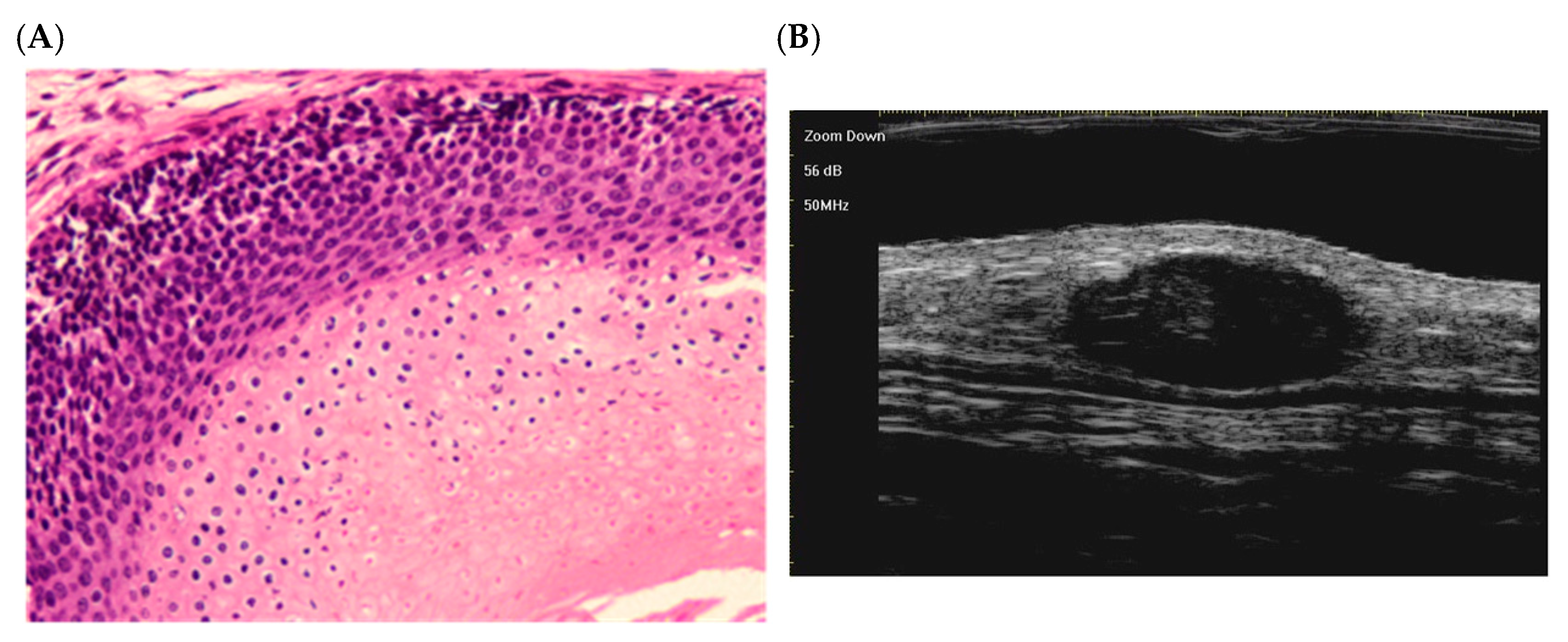 Dermatopathology 12 00024 g002 Dermatopathology 12 00024 g002