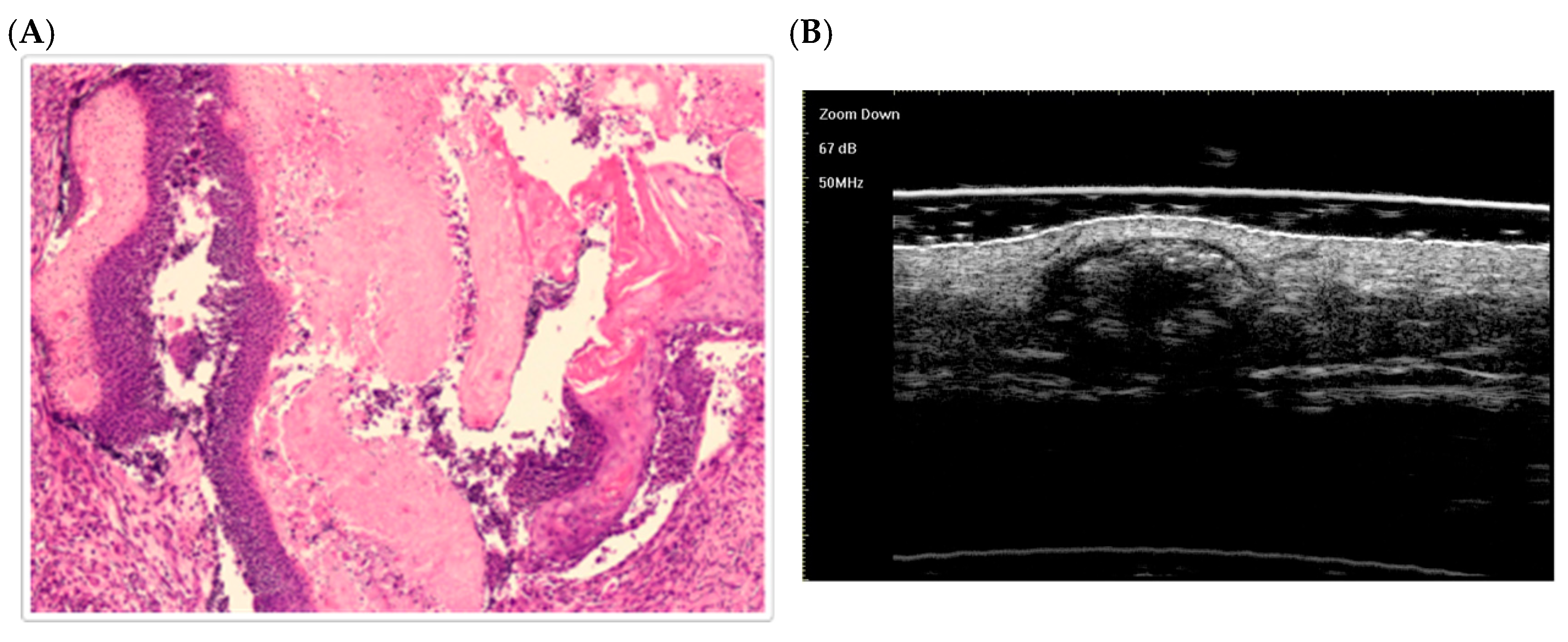 Dermatopathology 12 00024 g003 Dermatopathology 12 00024 g003