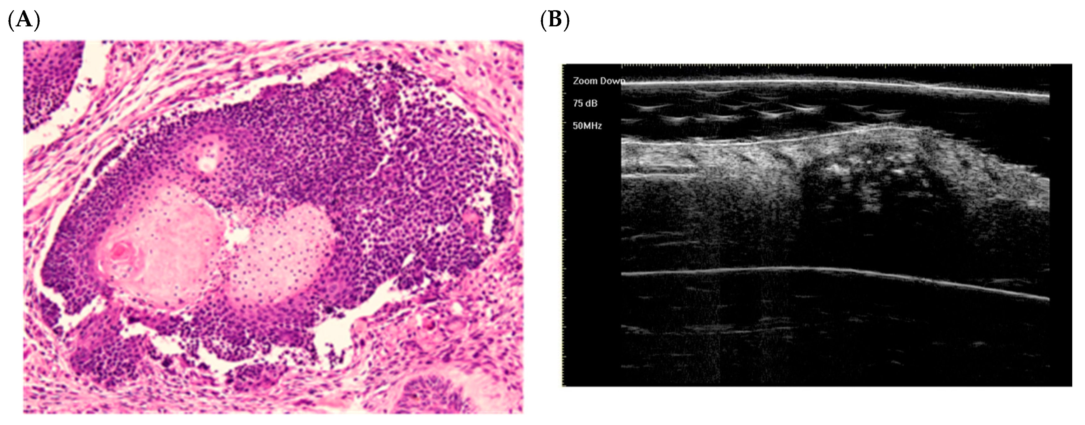 Dermatopathology 12 00024 g004 Dermatopathology 12 00024 g004
